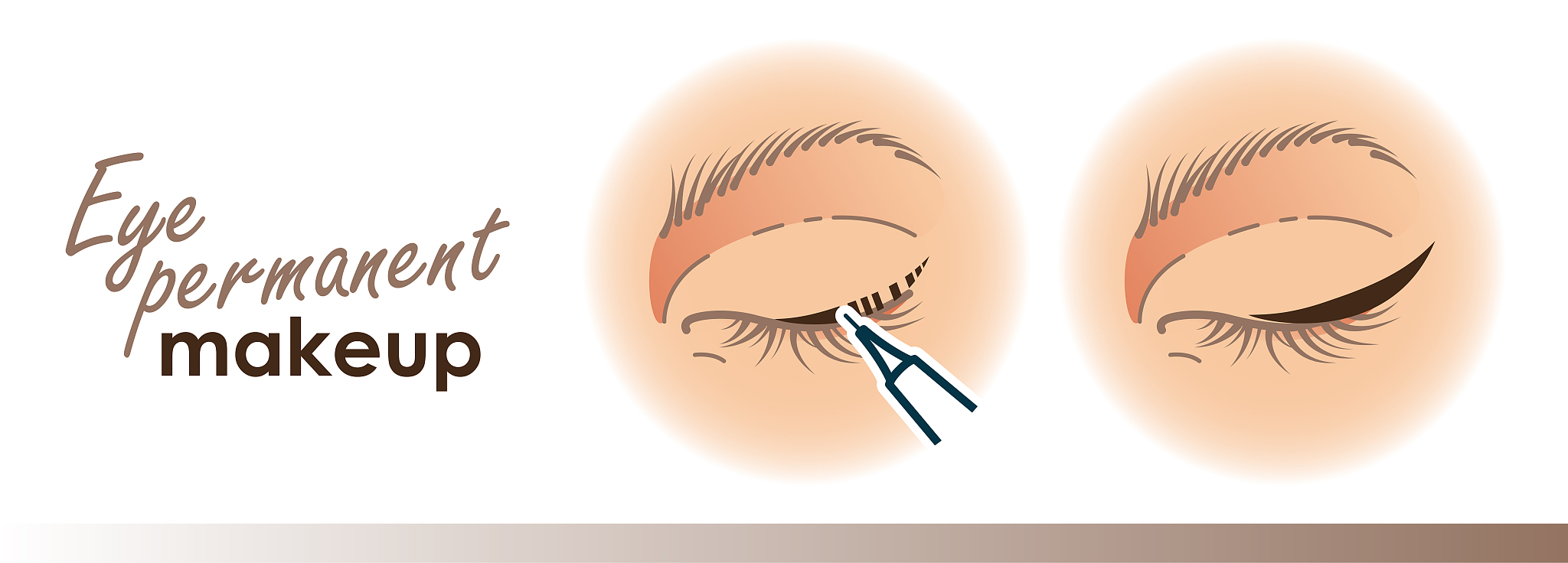 北京诺和注射笔维修：服务中心、医院、药店、在线购买