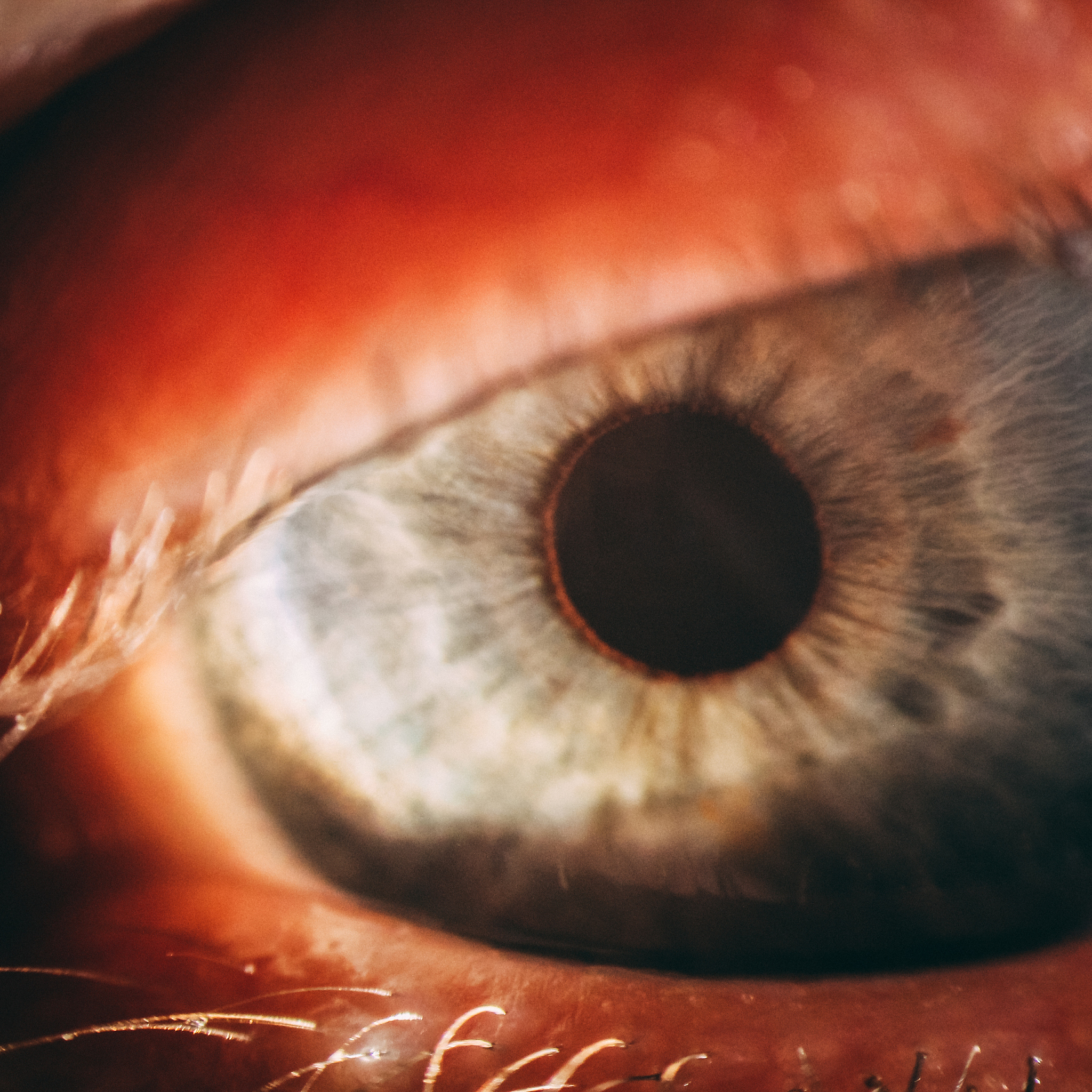 enlarged image of an eye iris made with a slit lamp