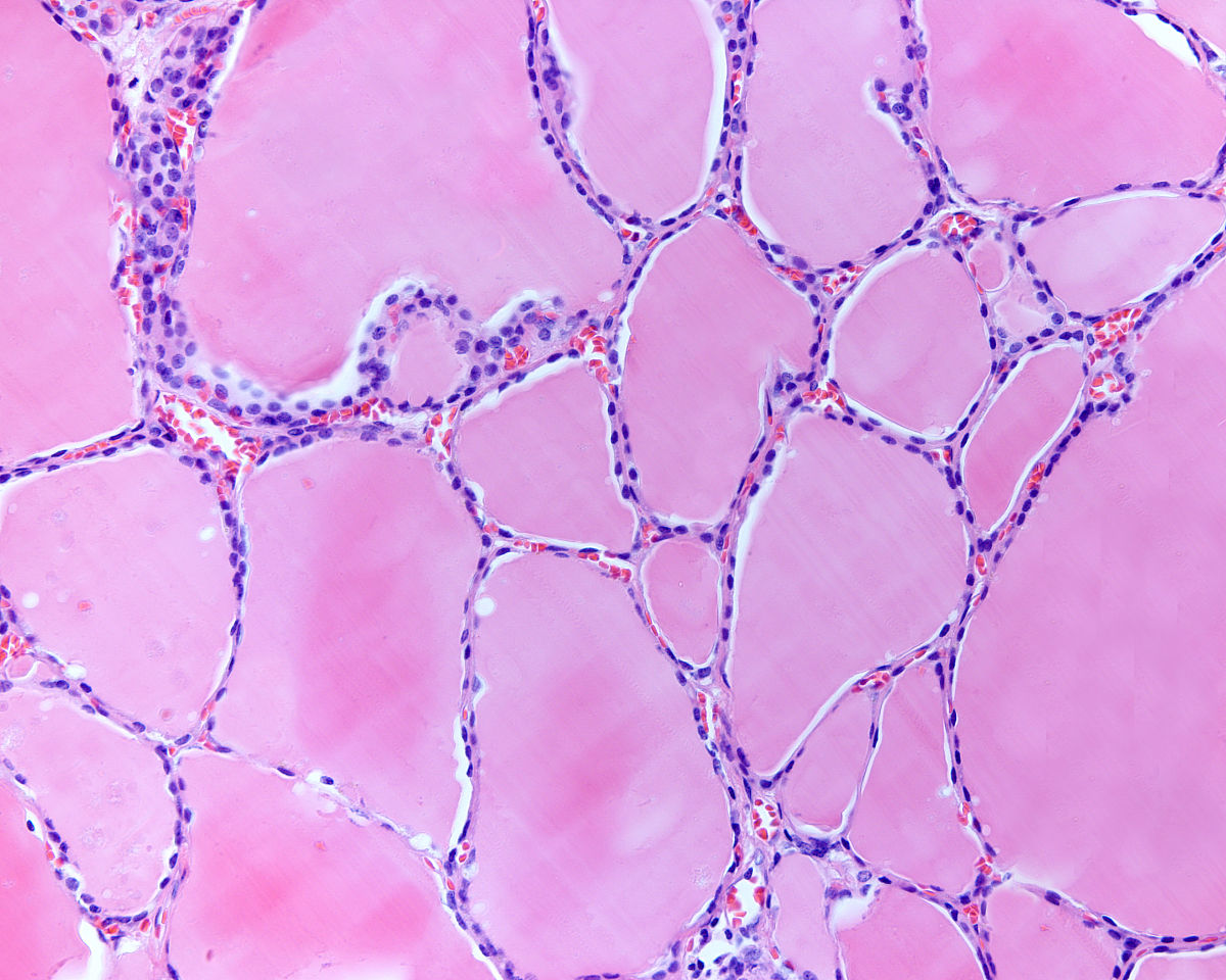 滤泡：定义、类型、功能及相关疾病