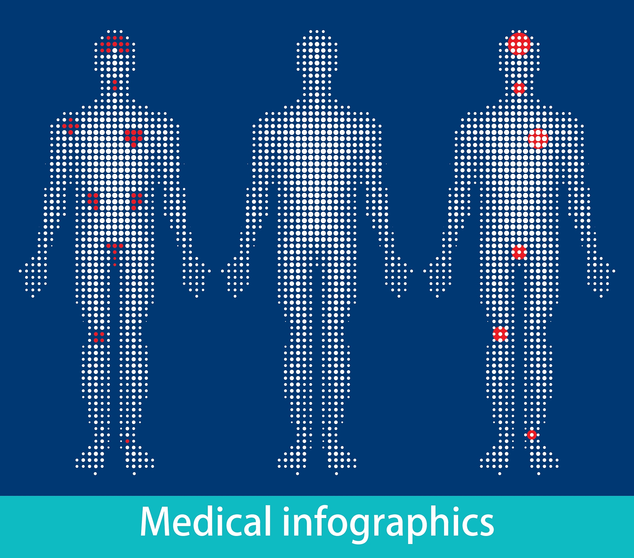 OpenPose 算法：深度学习人体姿态估计原理