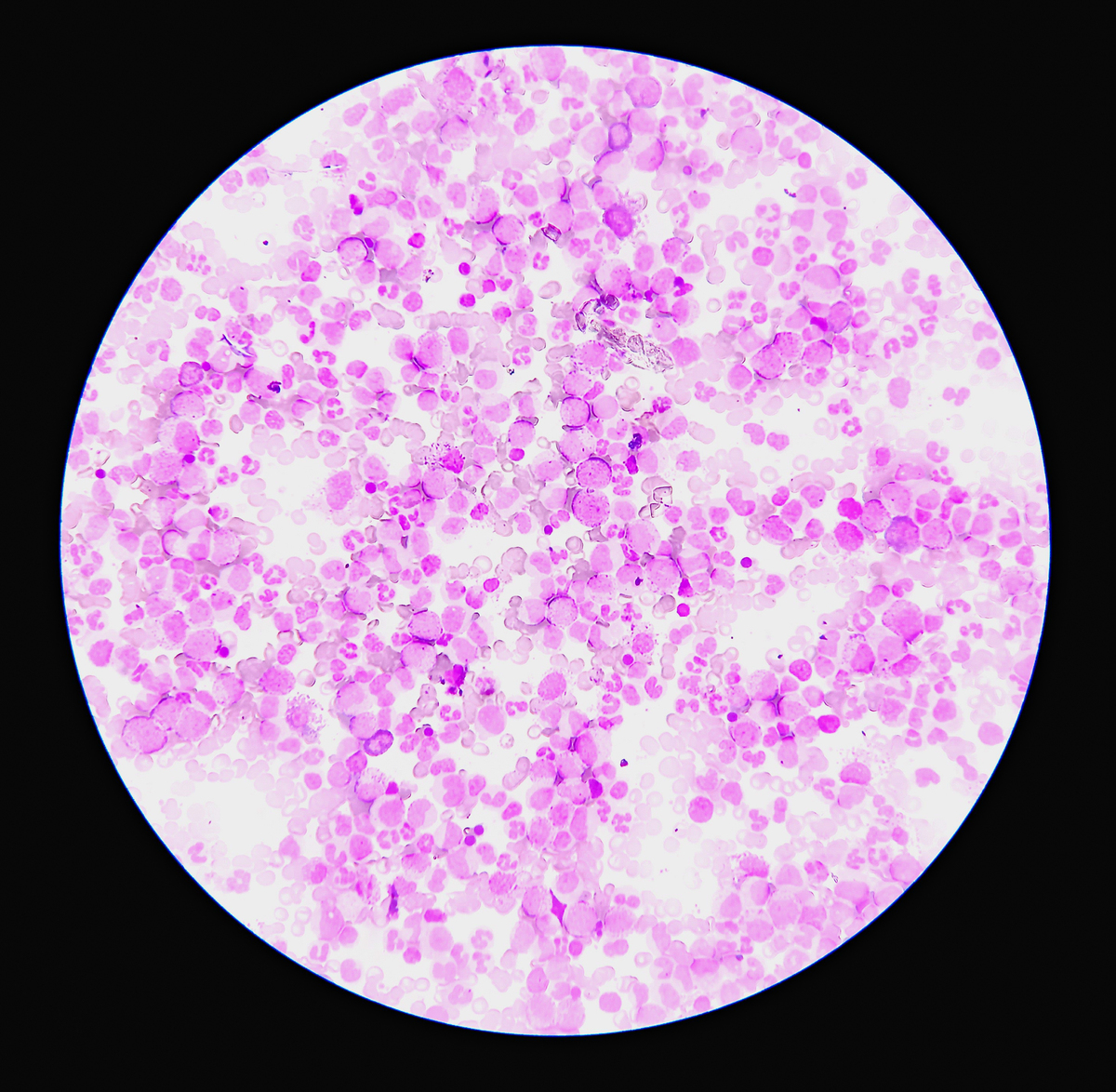 美兰染色后，红细胞呈现什么颜色？