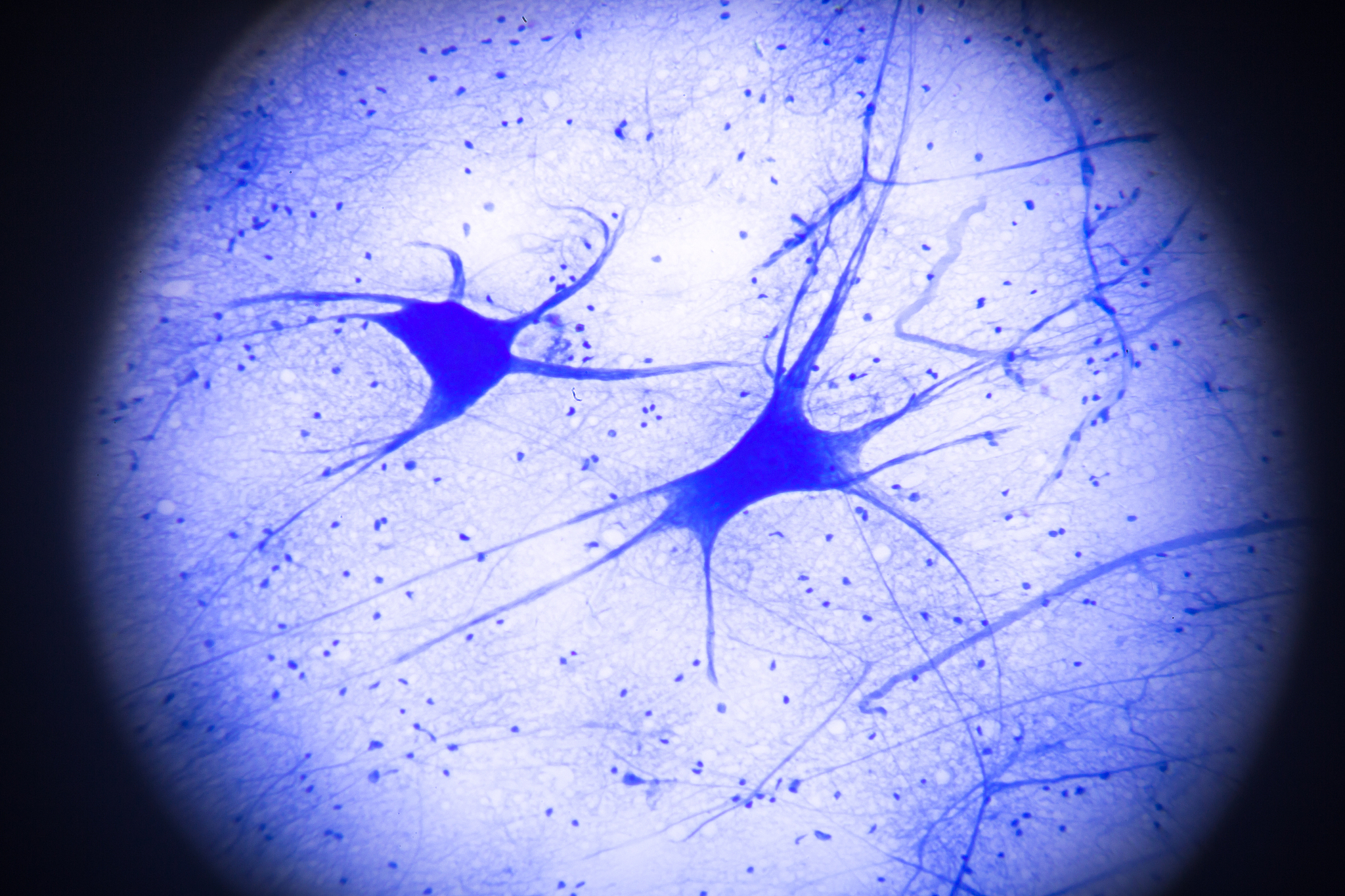 椎管内麻醉寒战