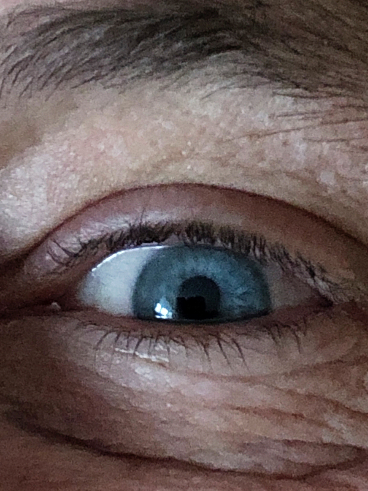 猩红的眼睛：如何改善眼部红血丝？