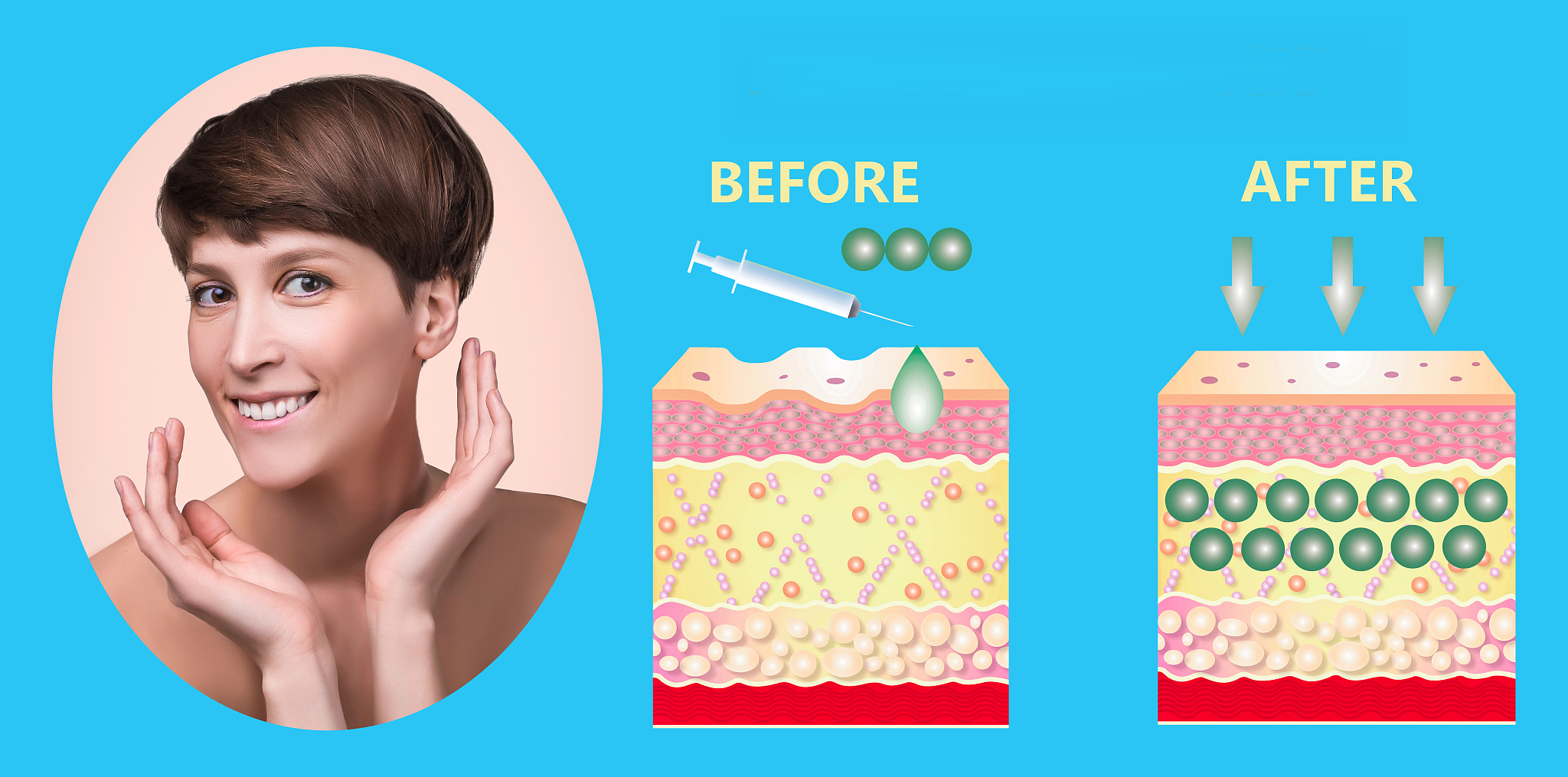 黄金微针：一针见效，重塑年轻肌肤