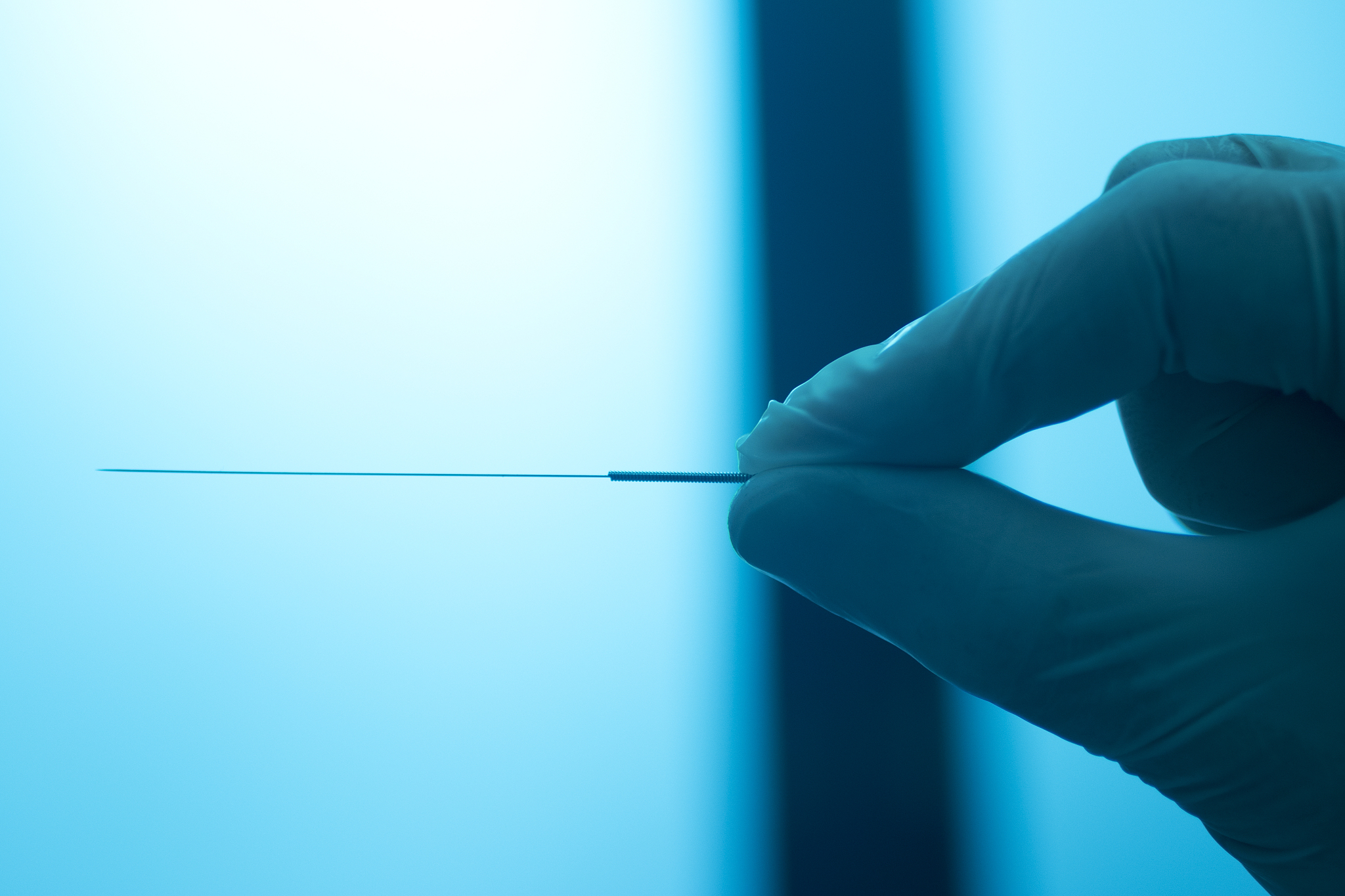 close-up of hand holding acupuncture needle