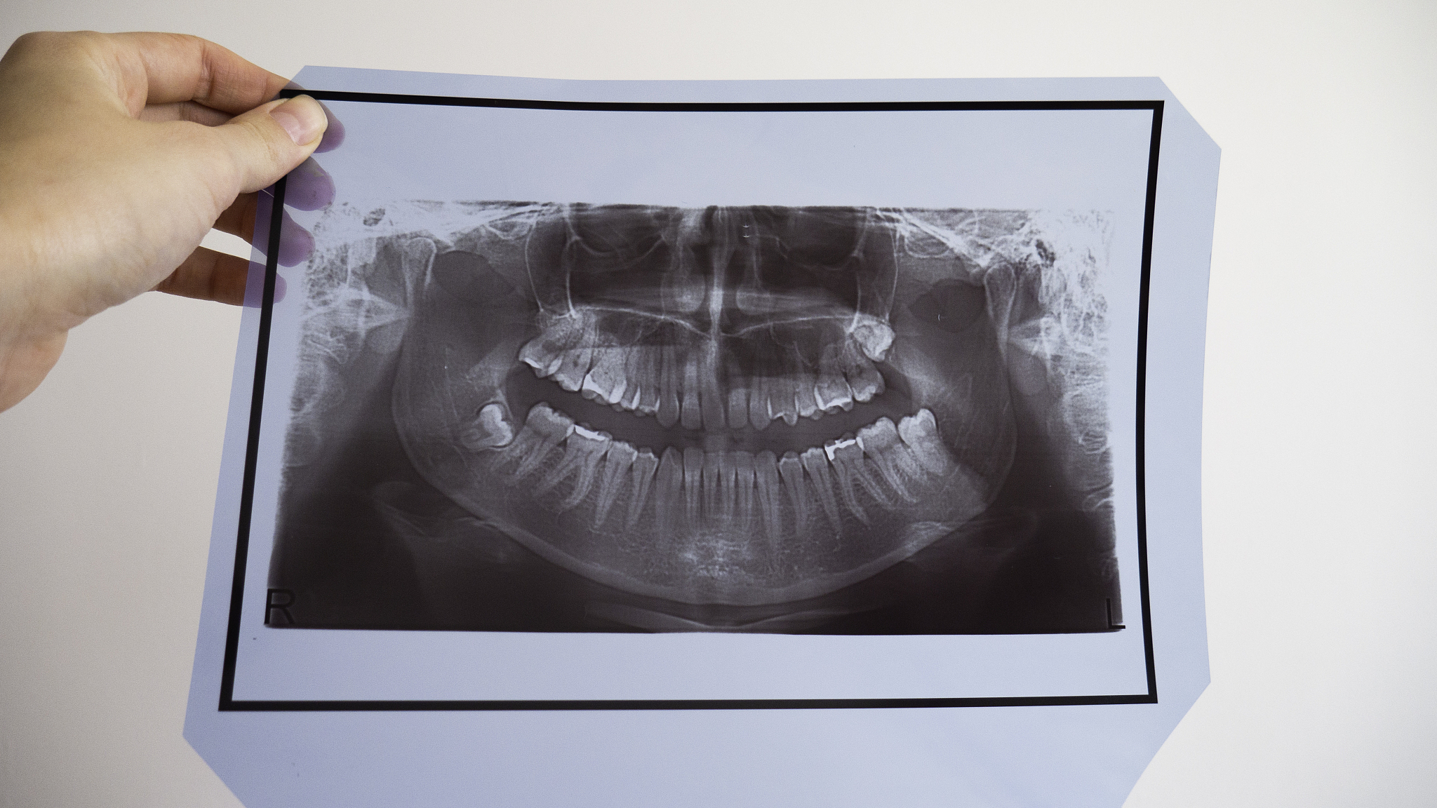 朝阳市卫生学校2023年招生报名简章怎么样