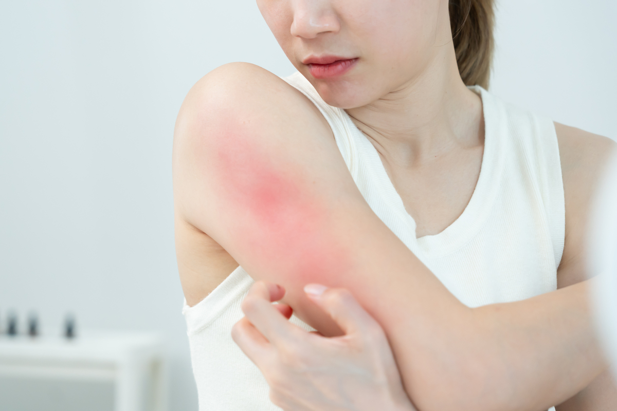 身体触碰即发痒，僵硬反应，原因何在？