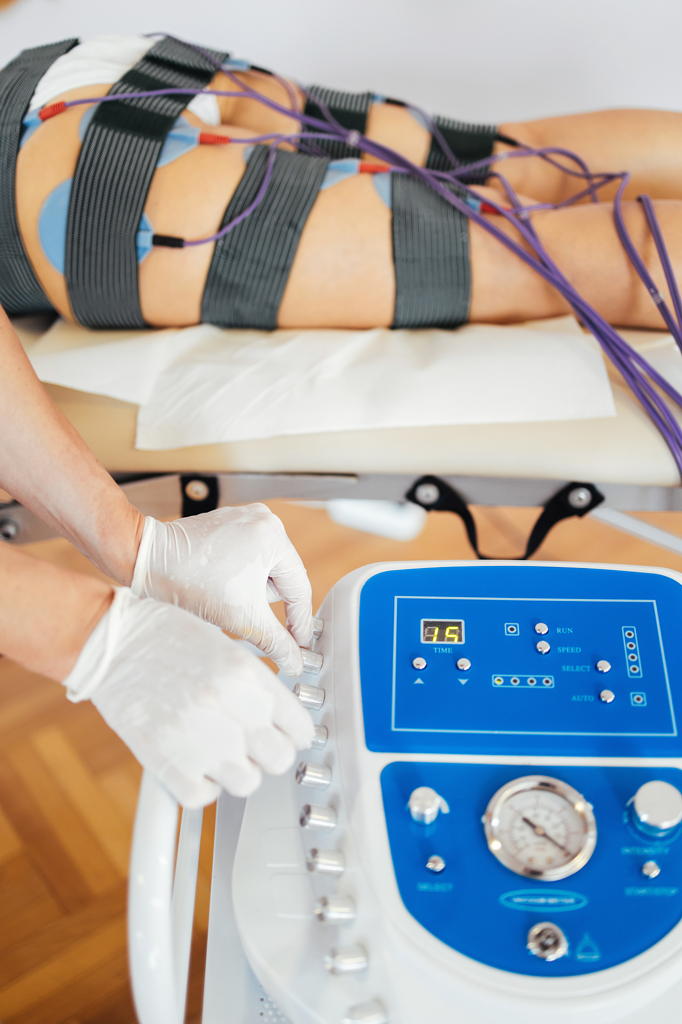 电针八髎穴联合盆底功能锻炼治疗压力性尿失禁