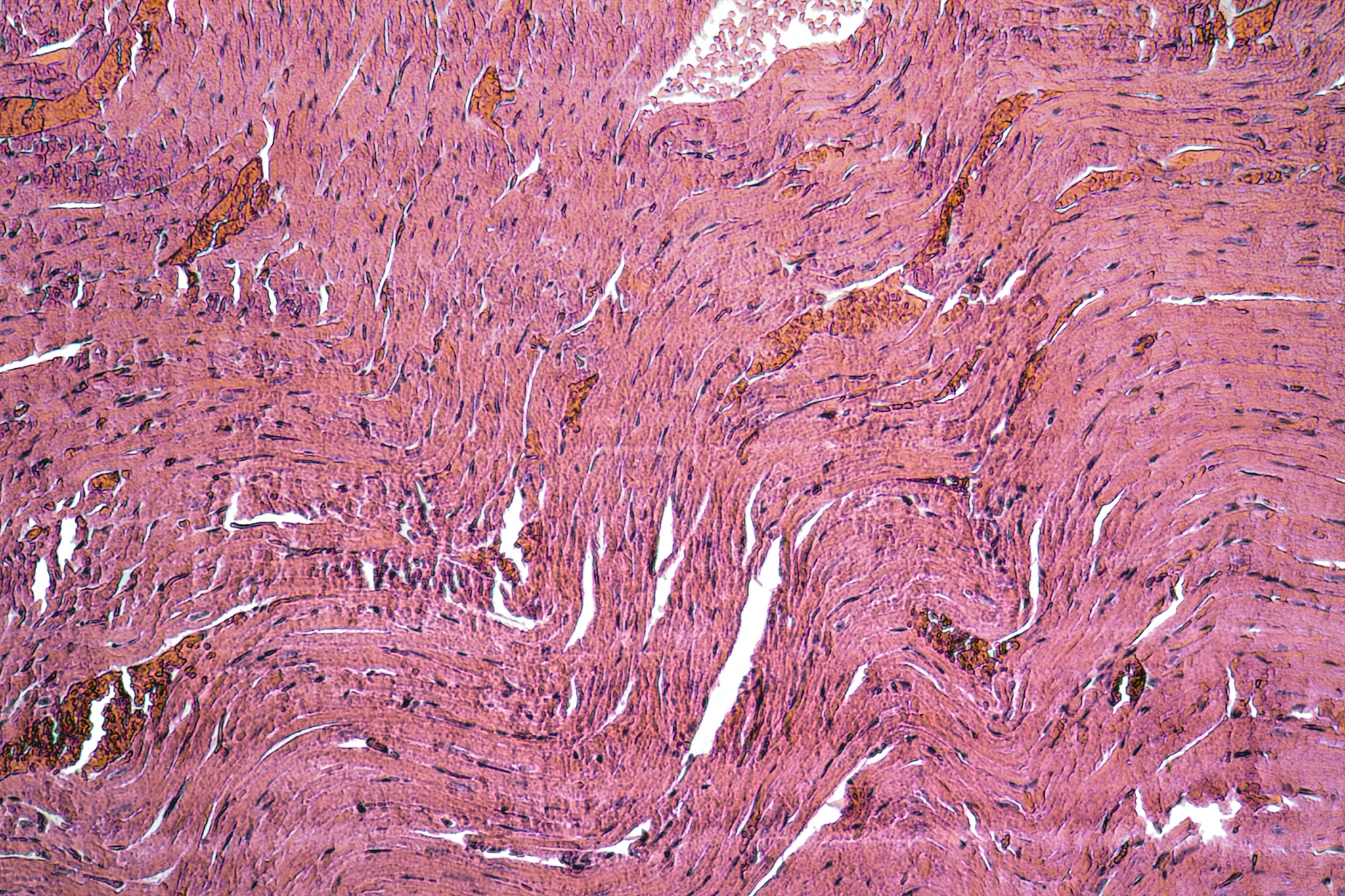 设计一项使用高内涵成像分析系统的动脉粥样硬化小鼠实验方案，并简述实验目的、样本制备方法、高内涵拍摄及数据处理方法。