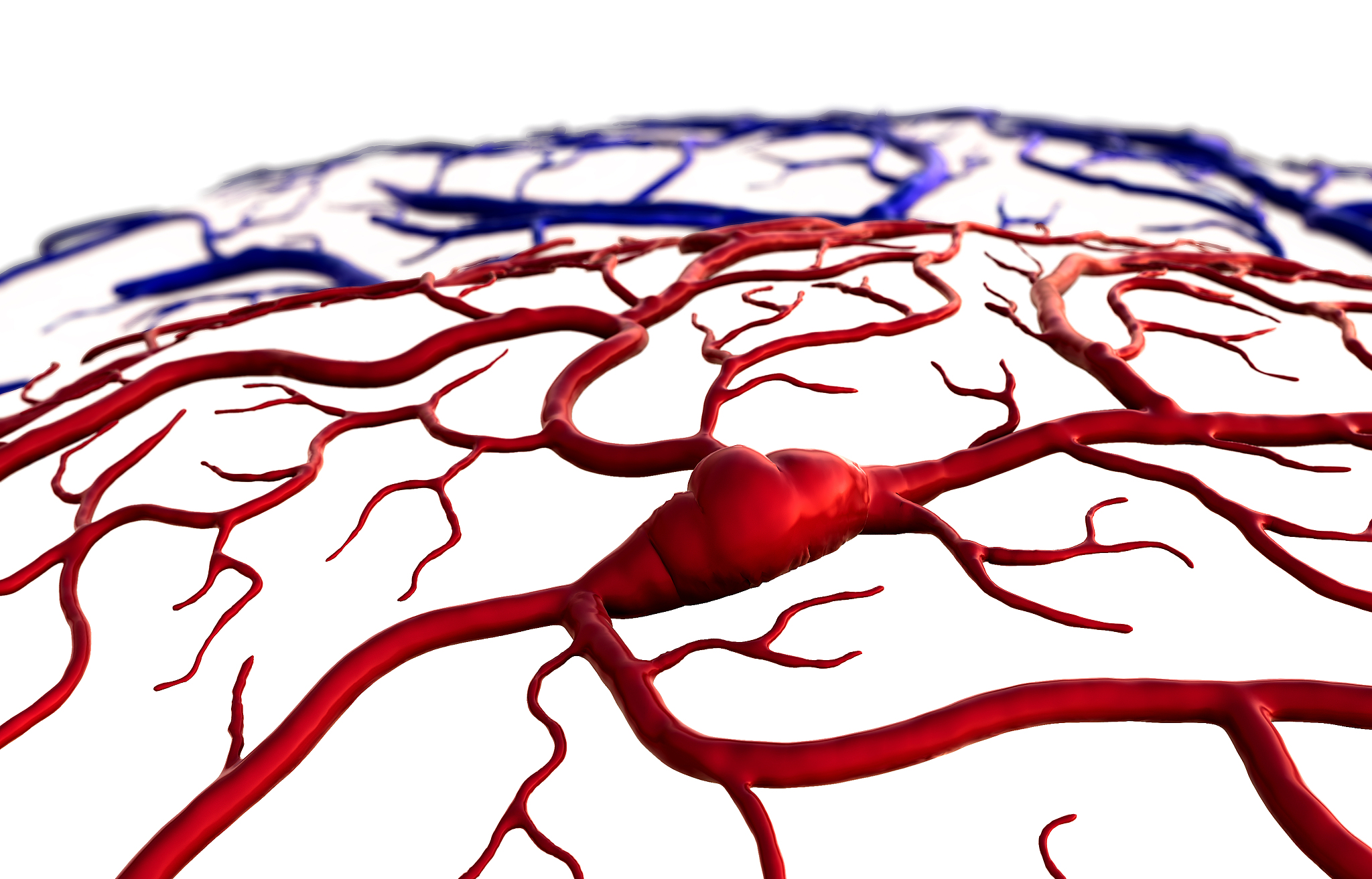 脑出血的定义的PPT