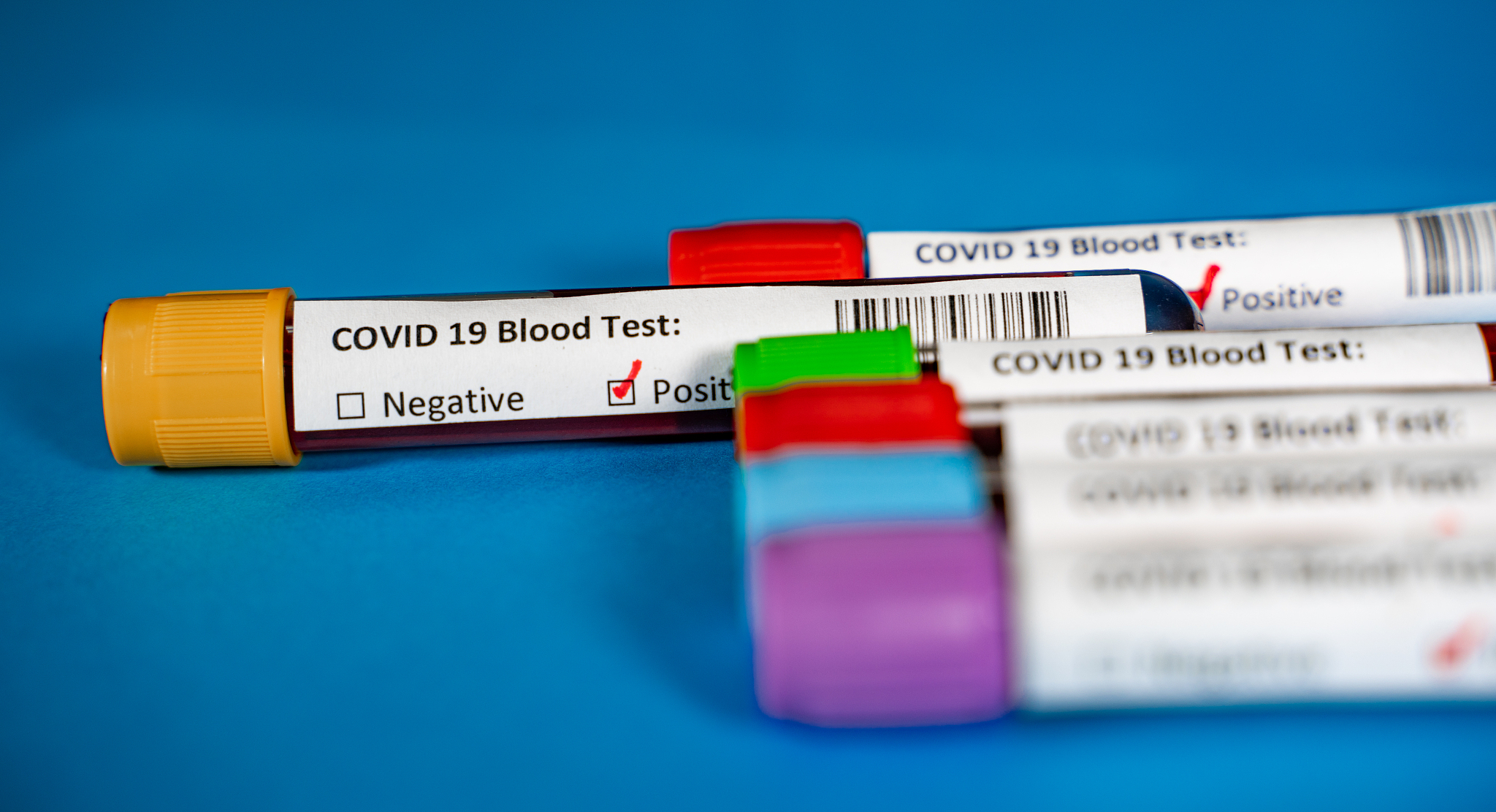 云南新兴职业学院药品质量与安全专业就业前景怎么样