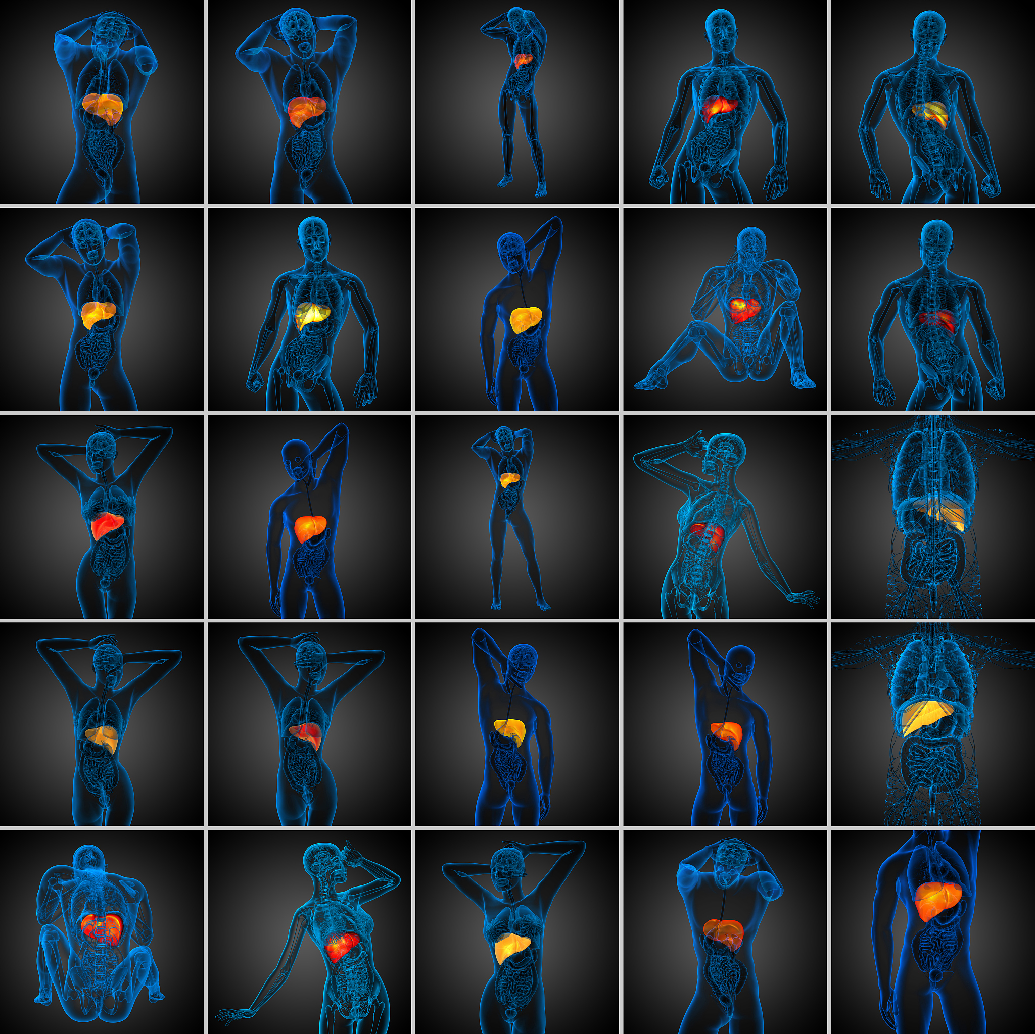 胆囊黏液囊肿：症状、并发症及治疗