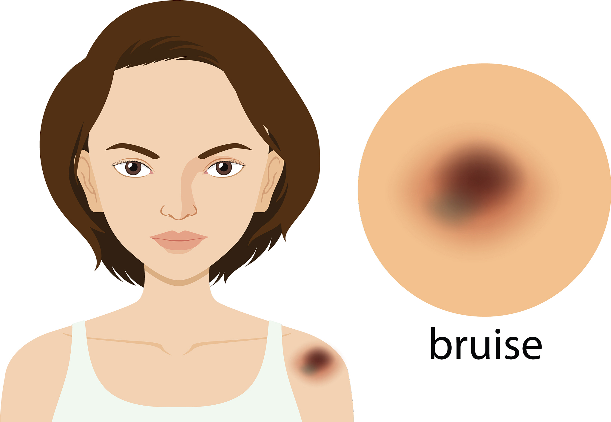 预防手术患者压力性损伤：全面指南与措施