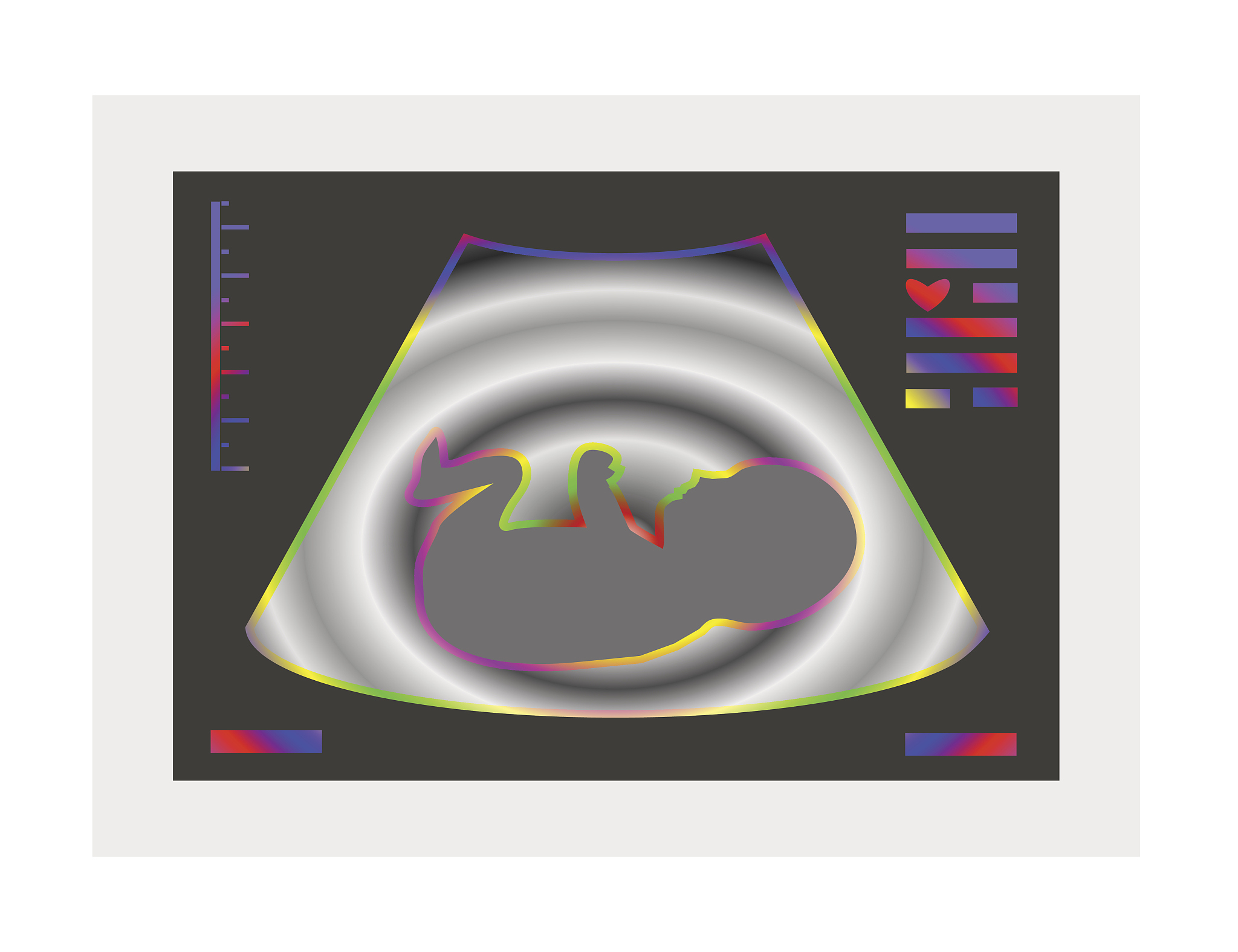 怀孕孕妇的孕酮太低是性激素引起的吗？
