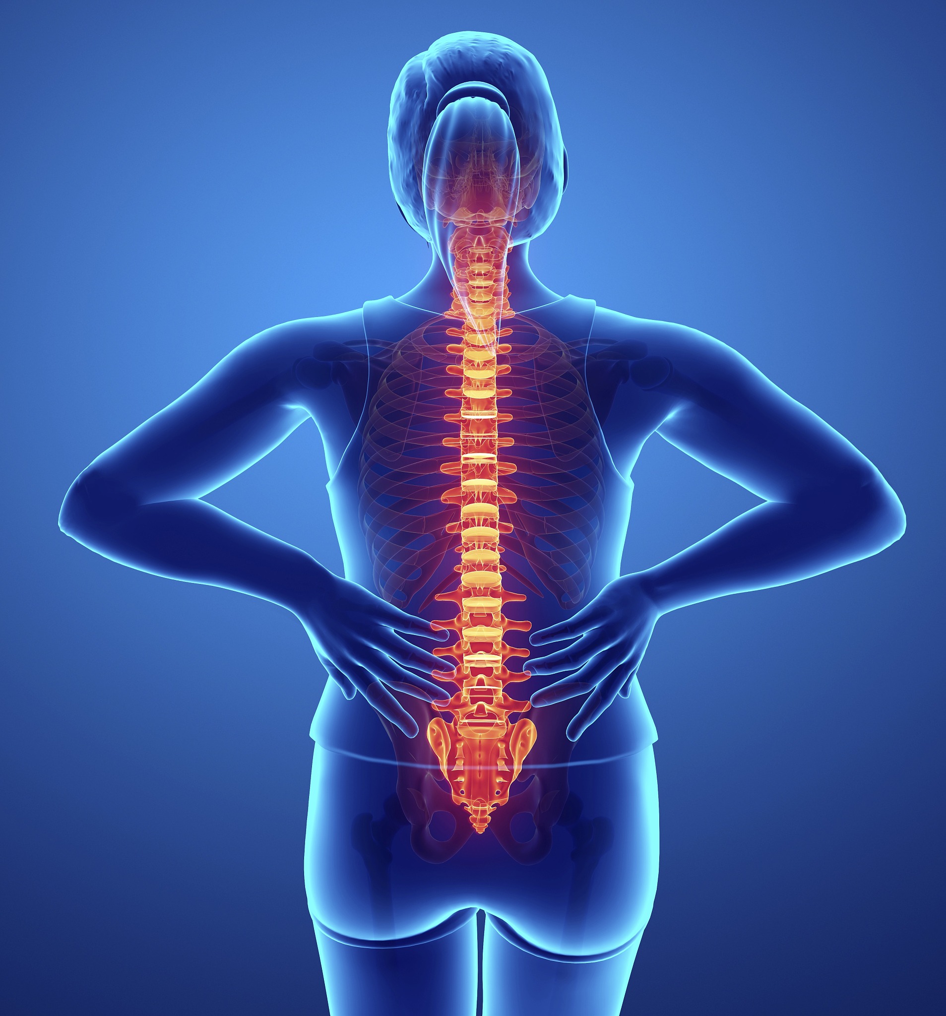 腰椎间盘突出：症状、原因、治疗和预防