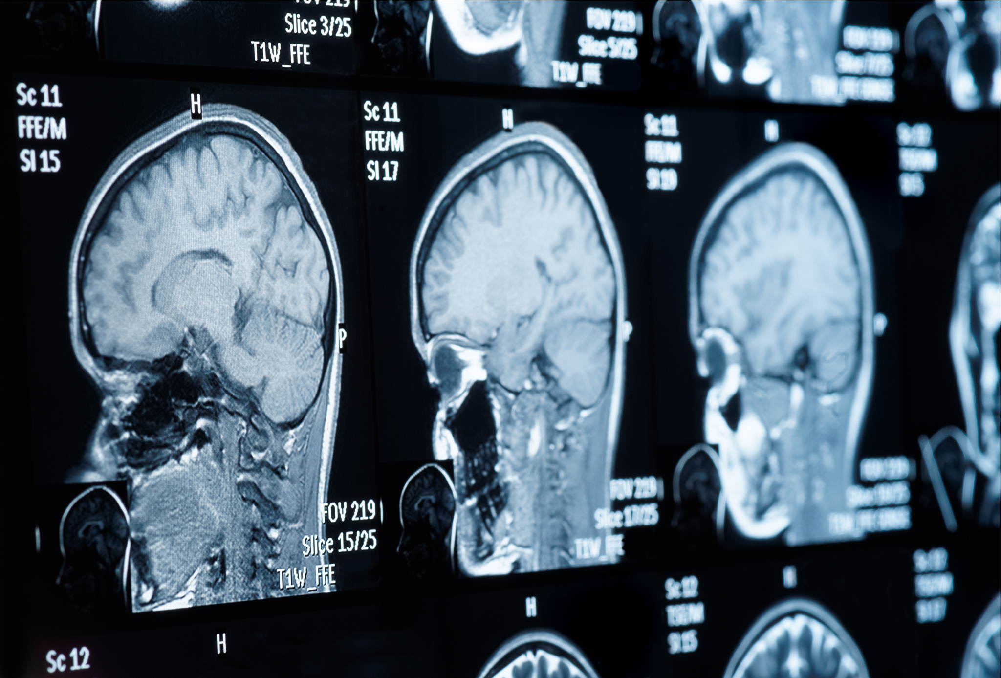 脑部专用正电子发射型计算机断层显像PET设备的使用方法和流程是什么？