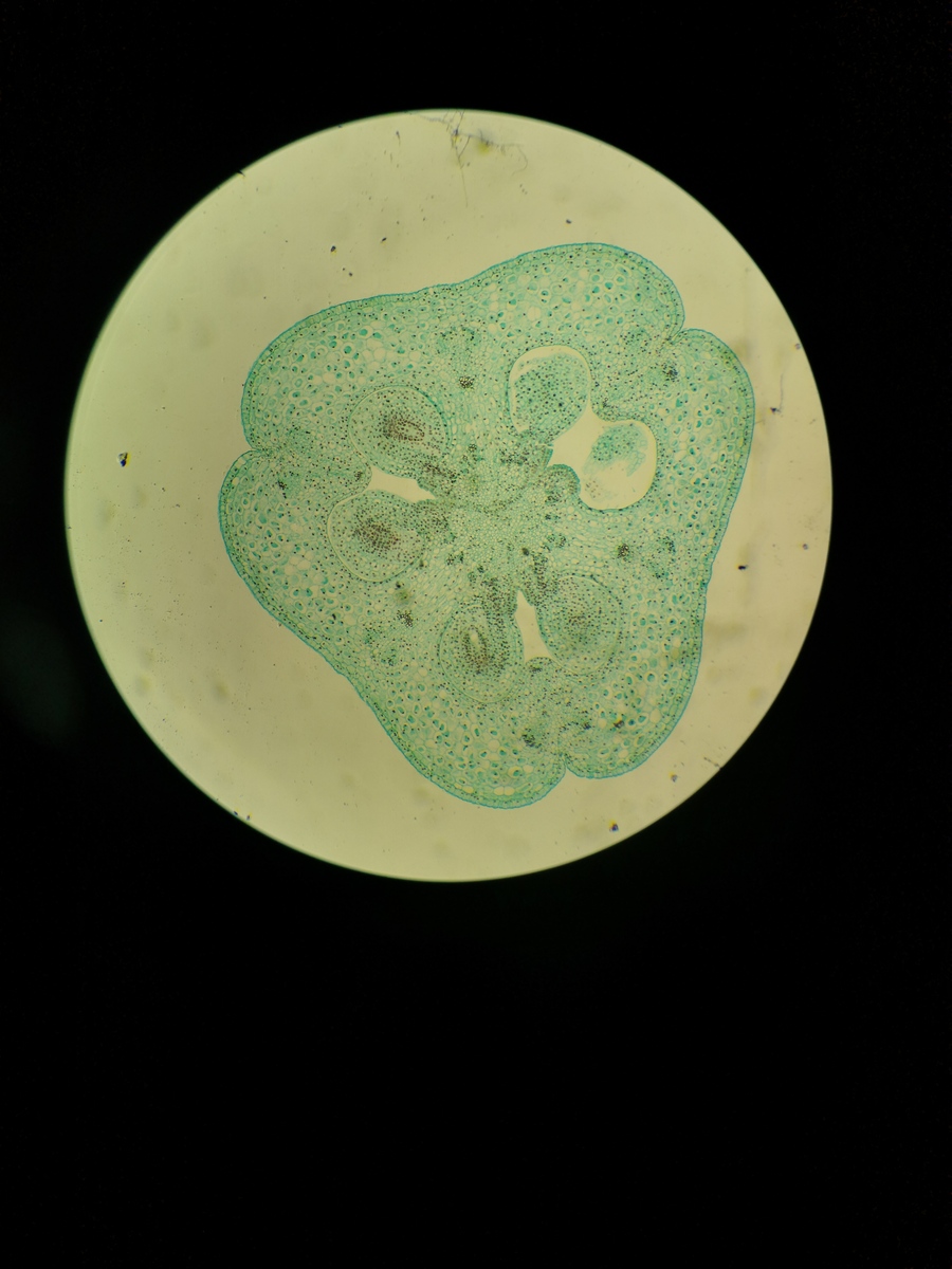 阿米巴：单细胞生物的特征、运动、繁殖与疾病