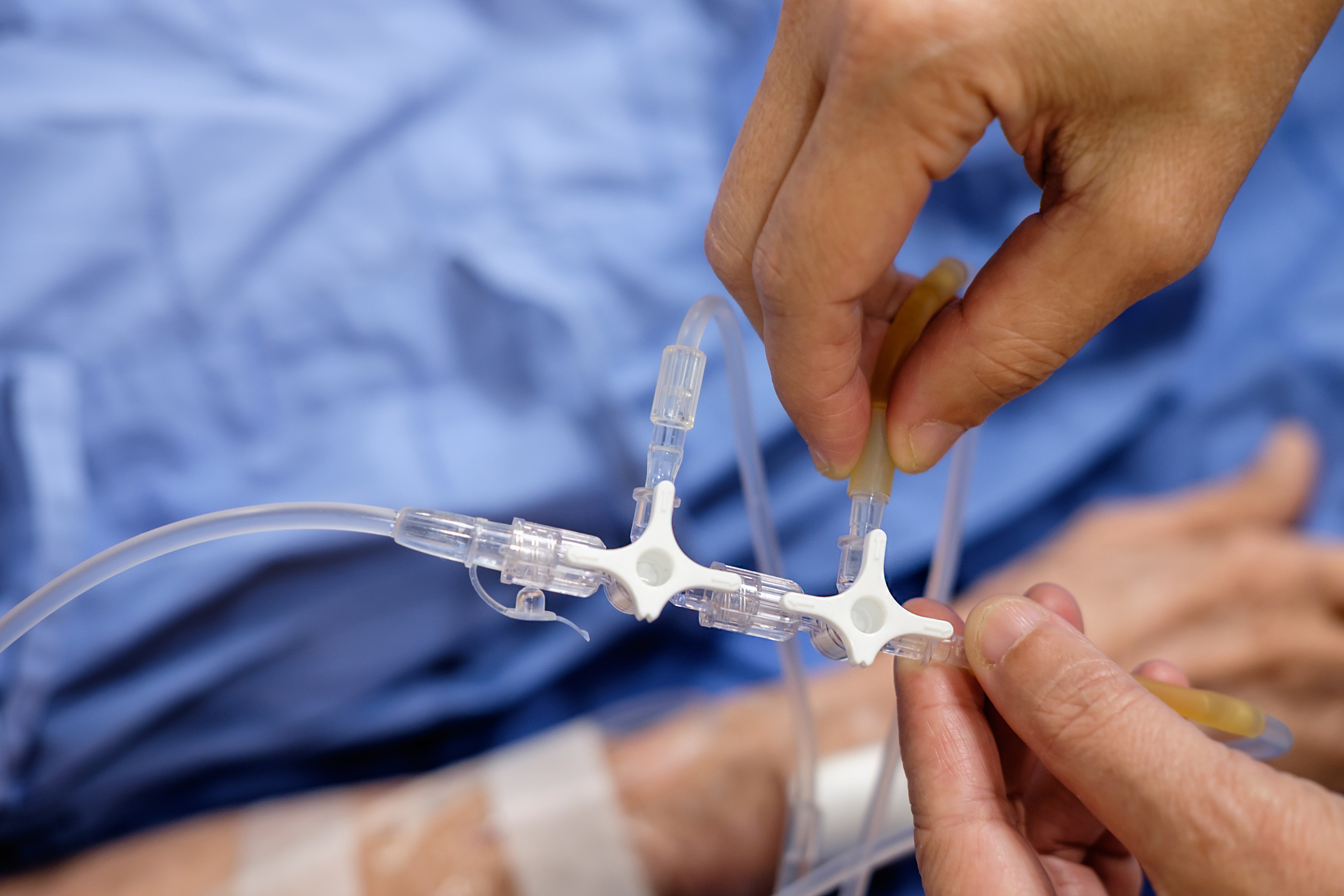 the nurse is changing the connection of the saline solution.