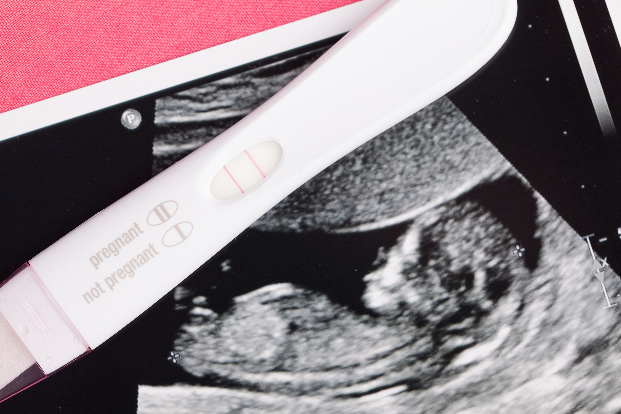 pregnancy joy, ivf, finally conceived