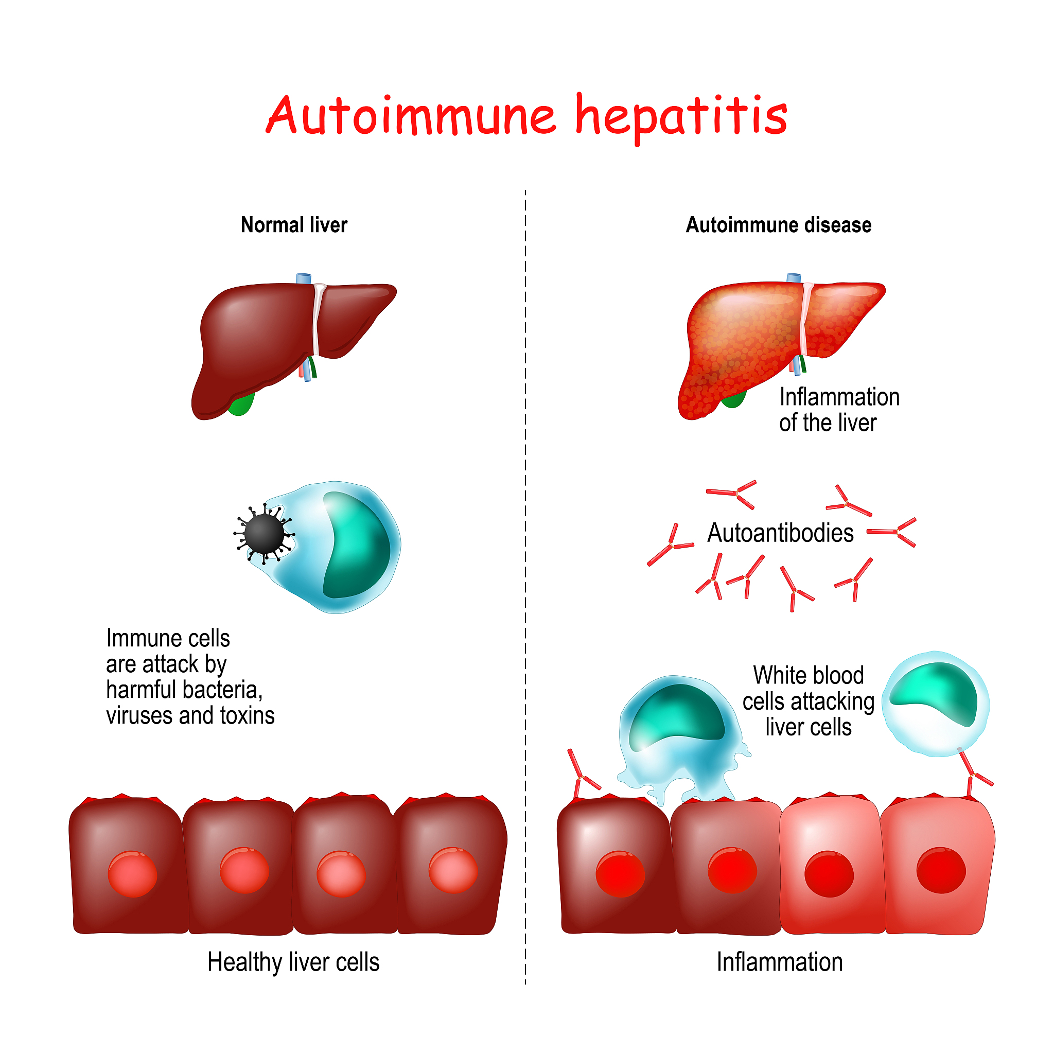 生理盐水和Plasma-Lyte输注对肾血流和容积的影响