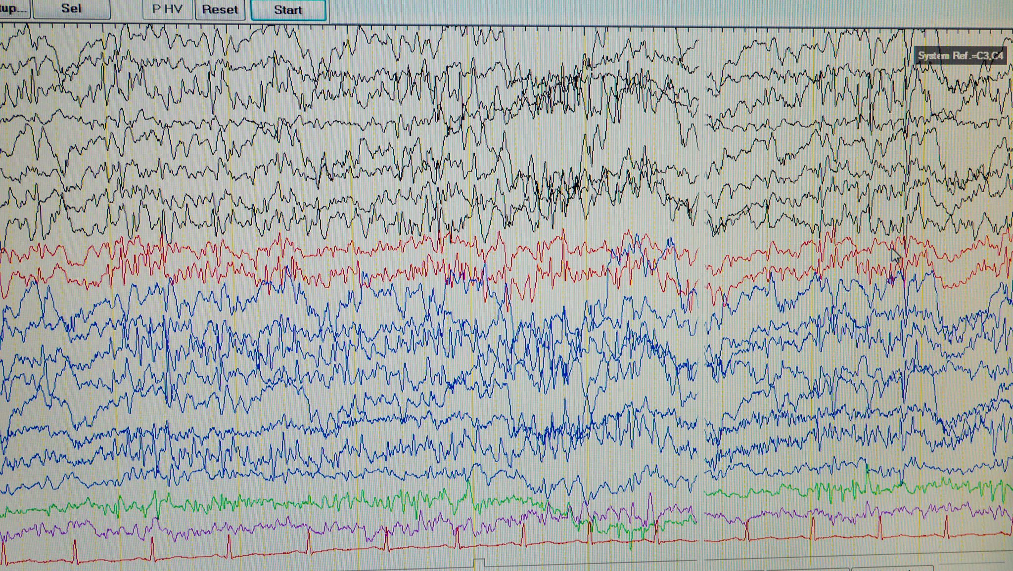 以调节风速变化范围为主题来制作脑检测仪的排列组合的决策范围