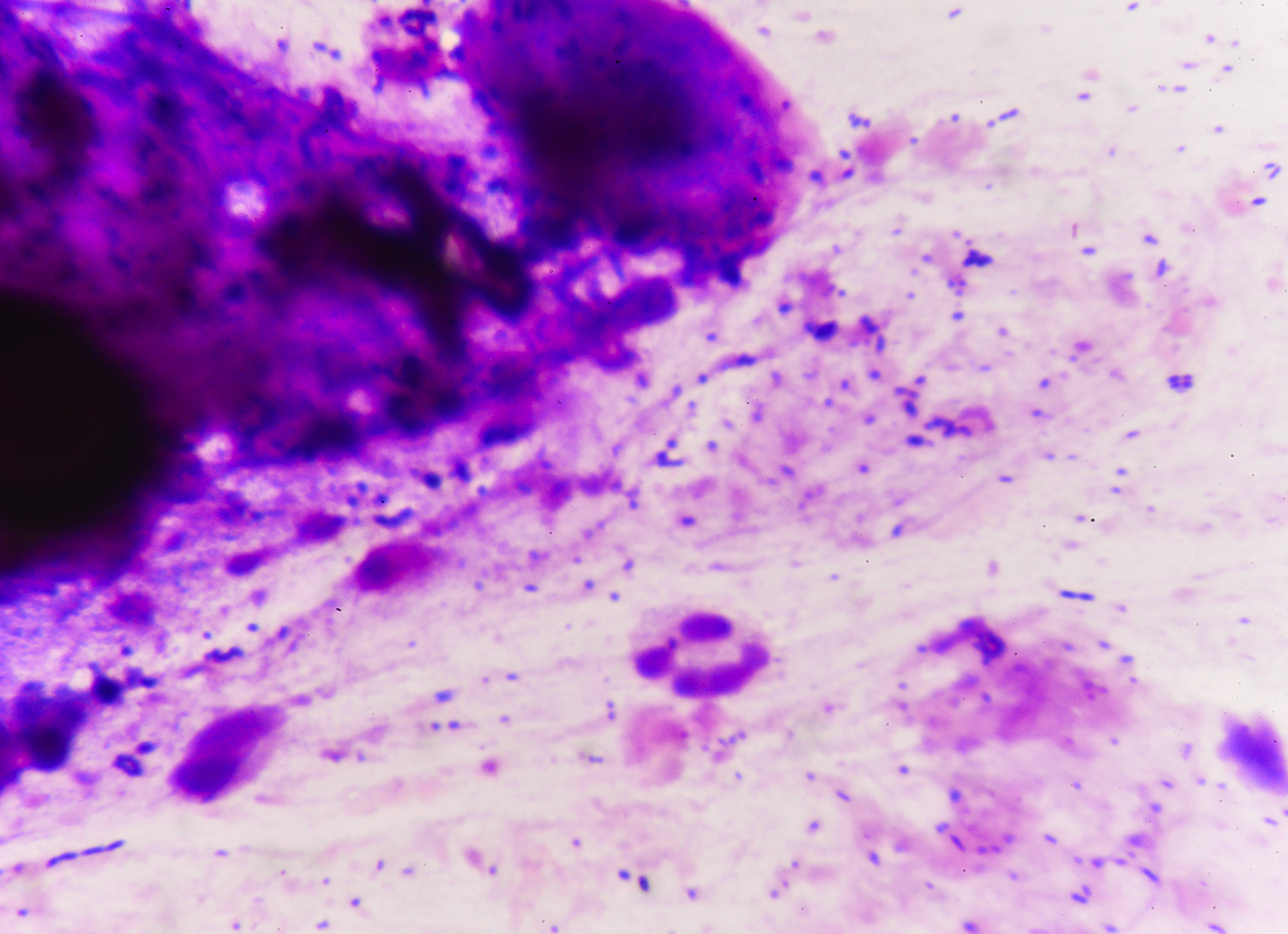 肠道中的厚壁菌/拟杆菌的比例变低与炎症性肠病（IBD）有关，试述具体的原因或作用机理