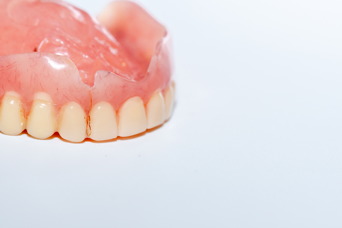 隐形牙套加电池安全吗？如何避免潜在风险