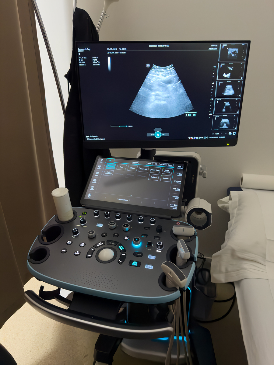 普通超声检查 (Conventional Ultrasound Examination) - 全面指南
