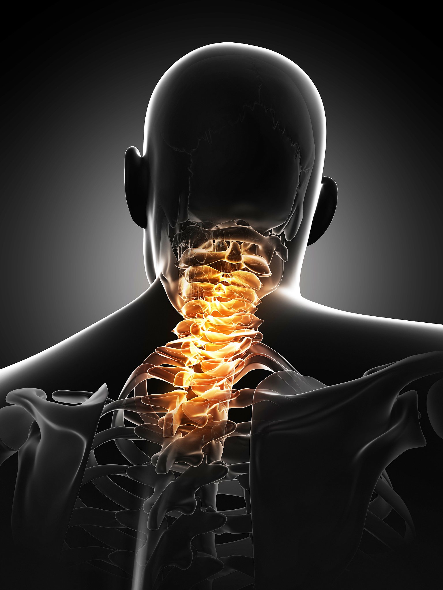 脊椎问题会导致头晕恶心吗？答案是肯定的！