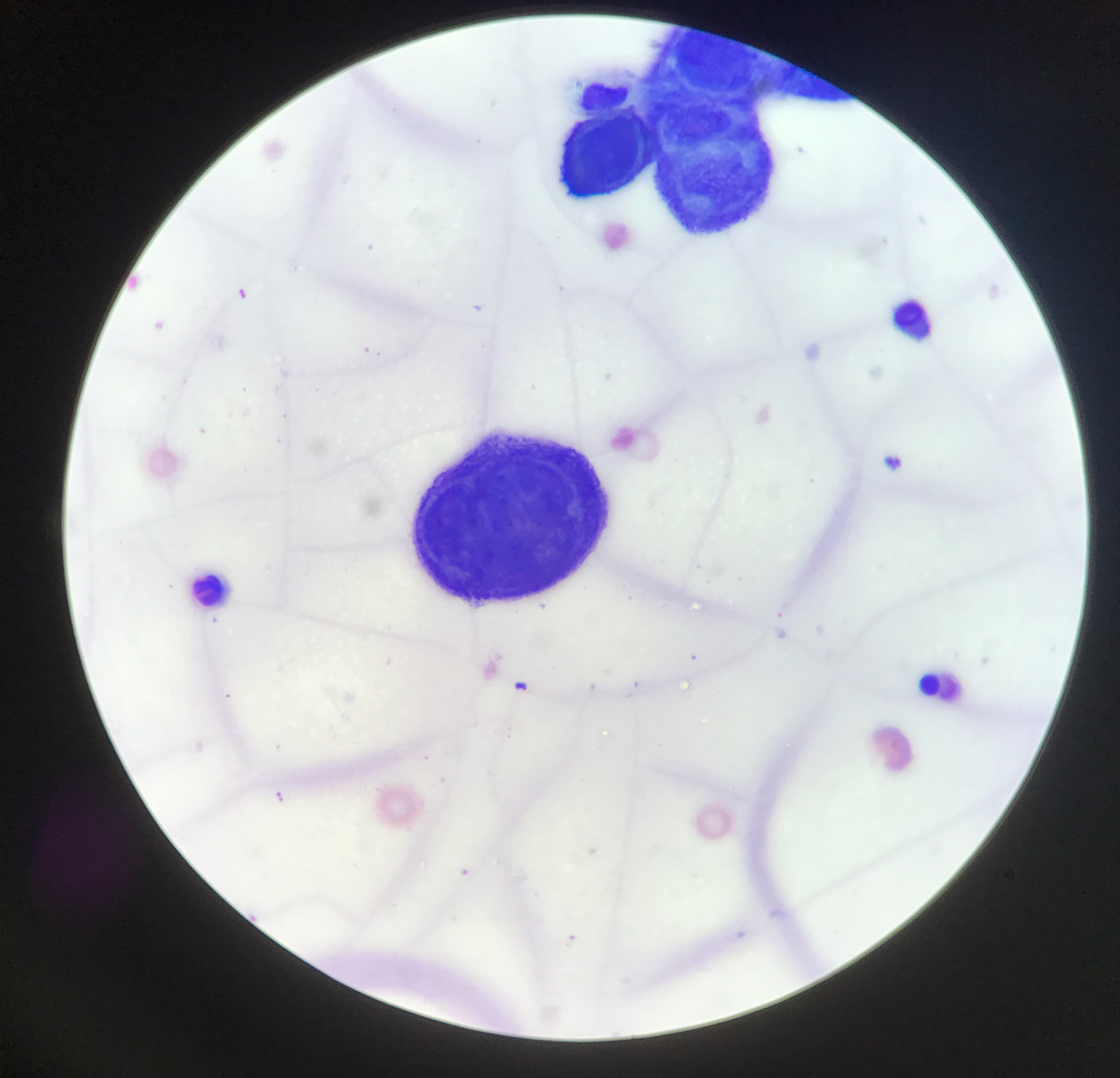 糖被显微观察染色方法：苏丹III染色法