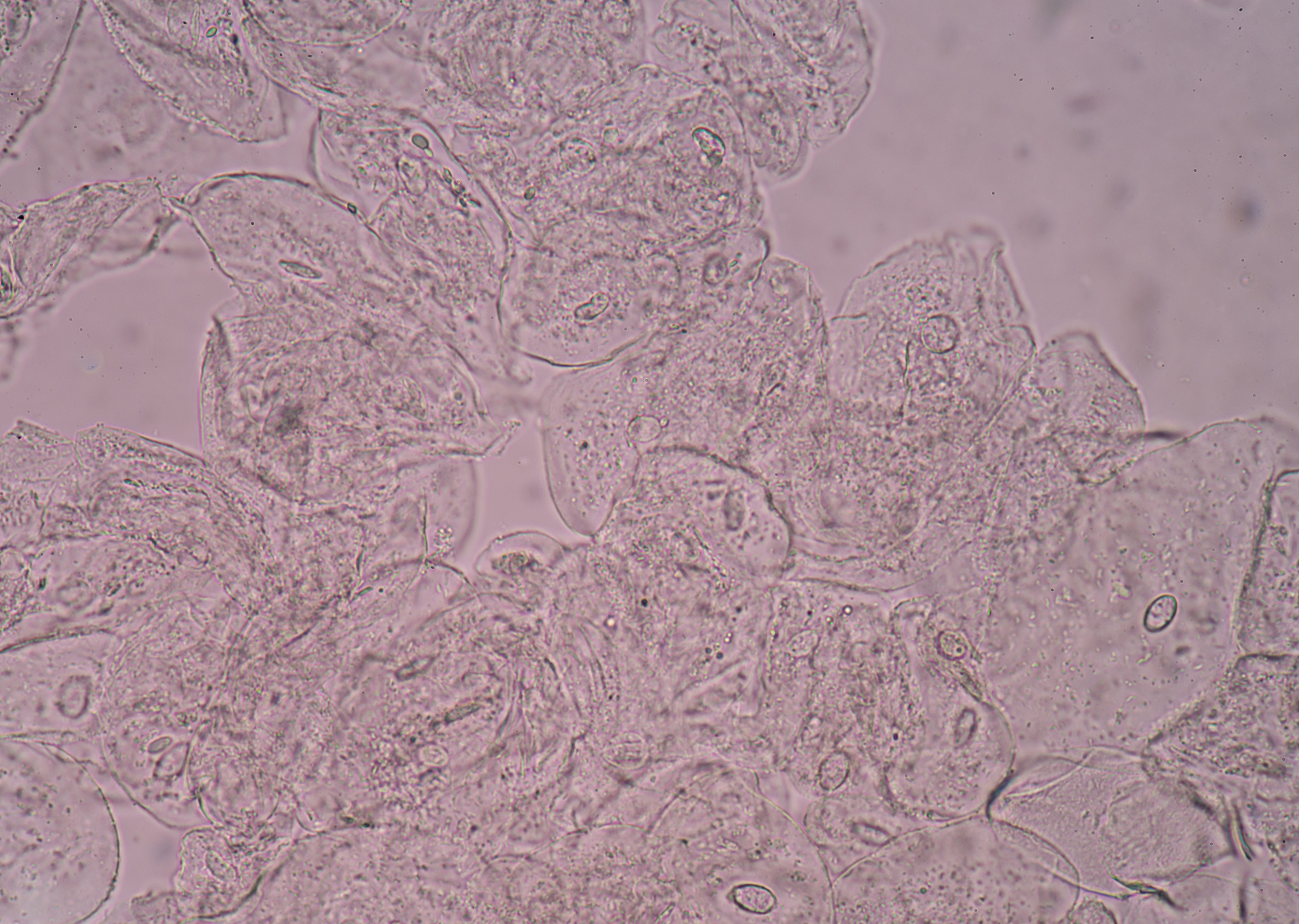 扁桃体隐窝上皮细胞请帮我把以上文字翻译成韩语