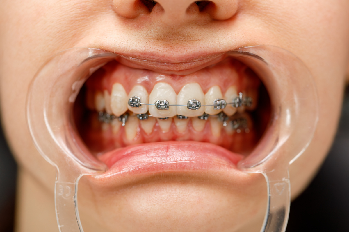 报考口腔医学专业值得吗？成都卫生院校口腔专业介绍