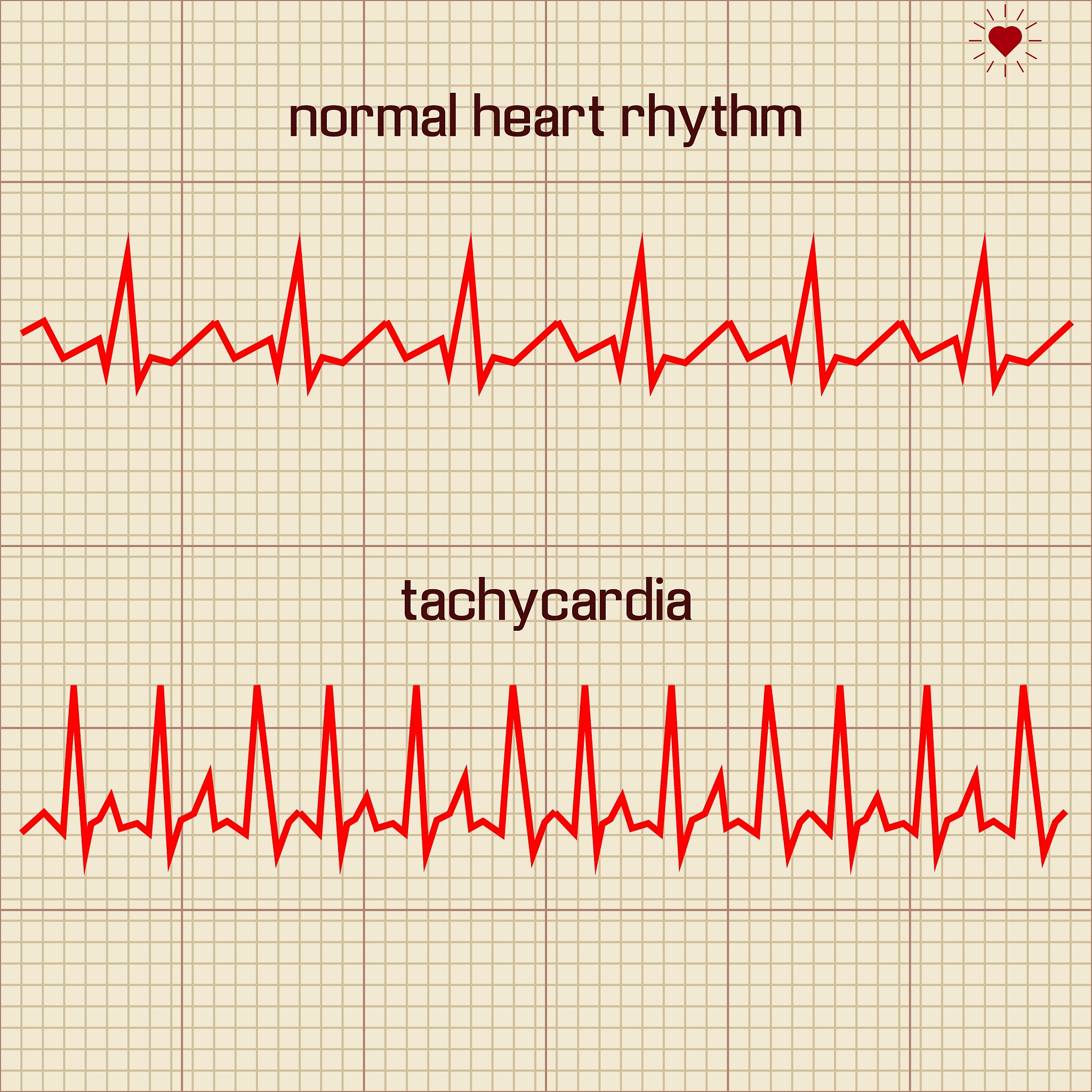 心率变异度低怎么办？改善方法及注意事项