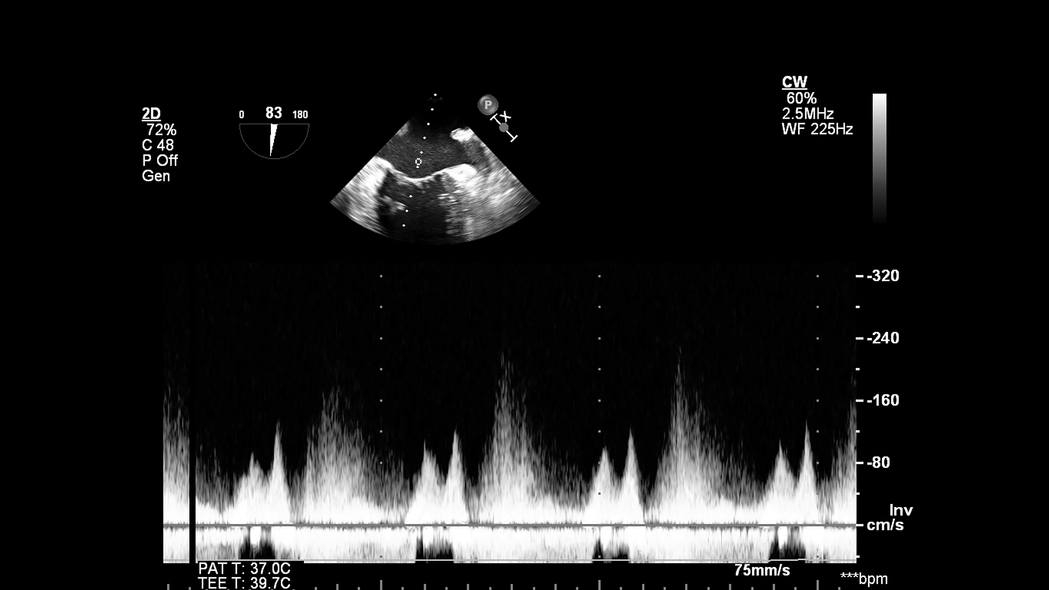 opencv用c++Canny边缘检测后出现不连续的情况如何调整