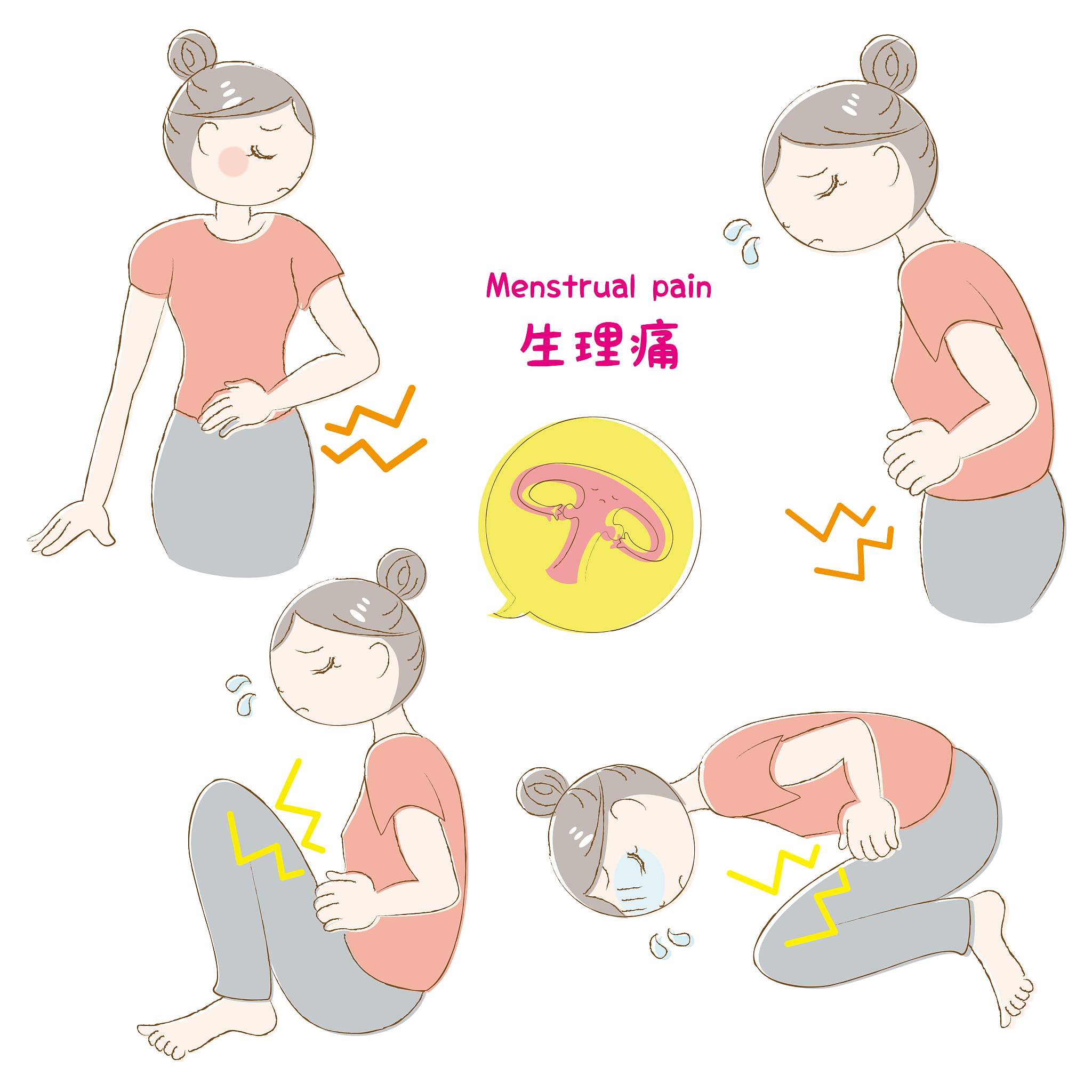 镇痛分娩是否会提高尿潴留的发生率请查阅文献后告诉我