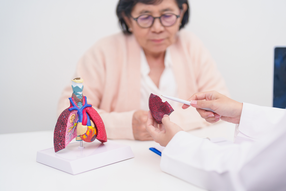 肺癌的雾化吸入护理