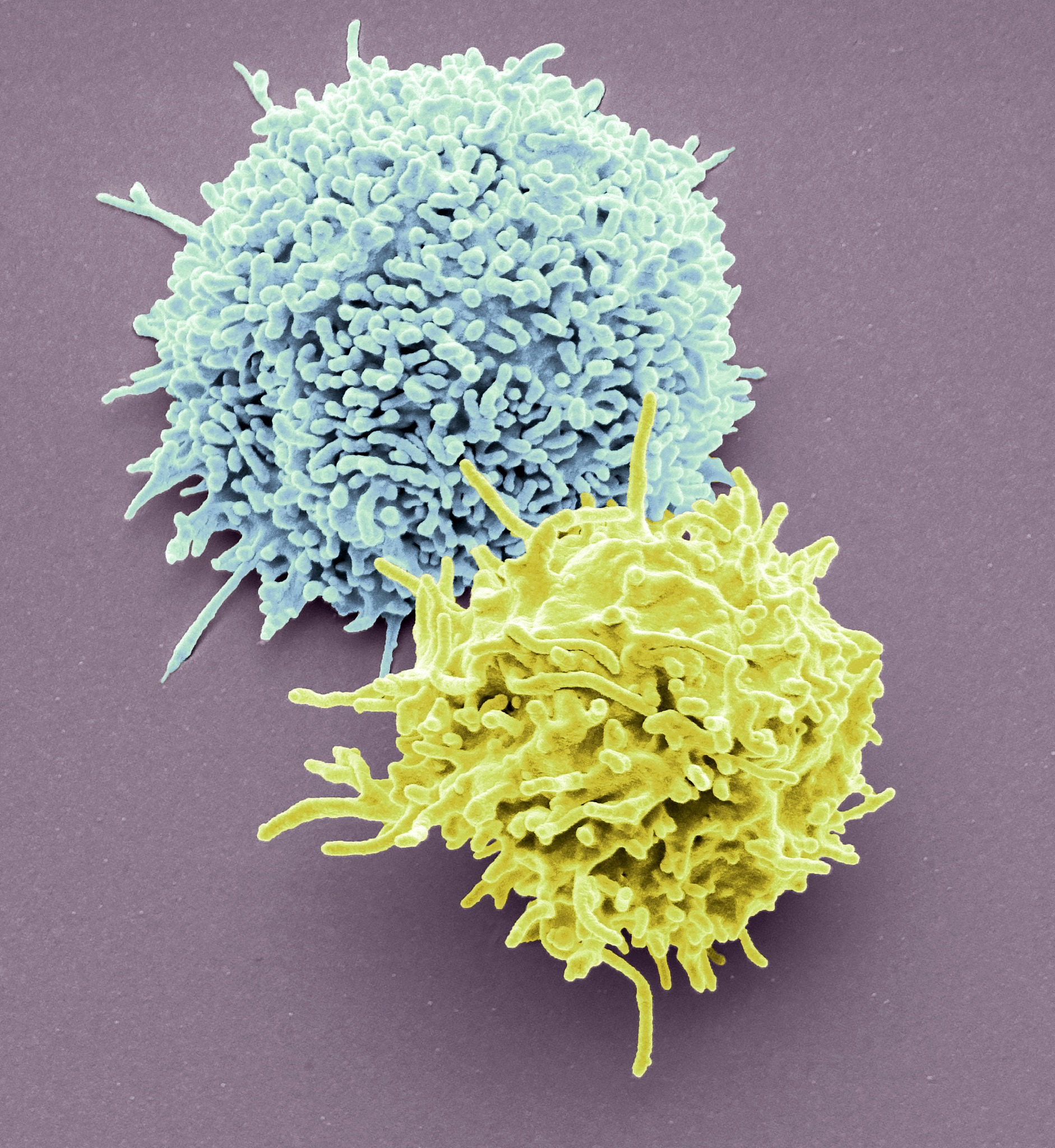 各种T细胞亚型在乙肝进程中的作用机制分别是什么