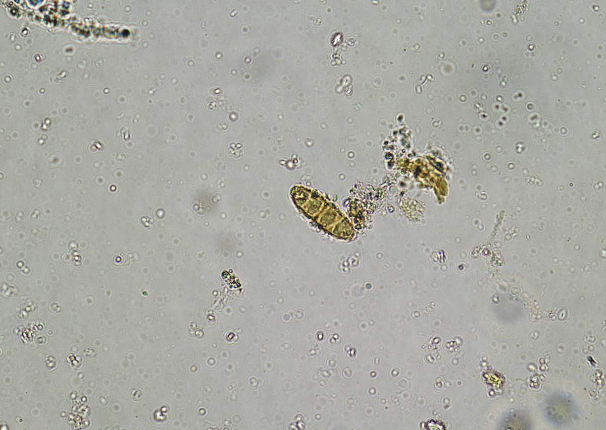 溶组织内阿米巴致病阶段：侵入、繁殖、侵袭