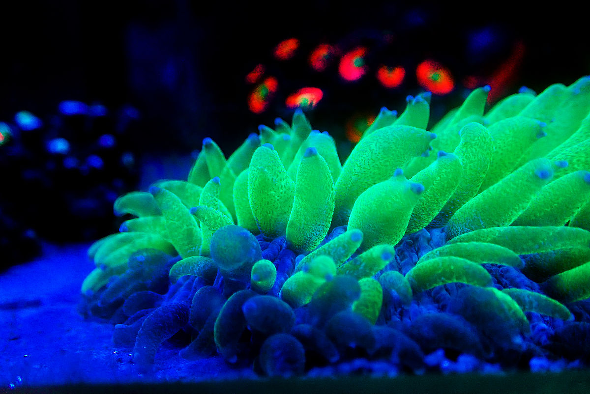 细菌的革兰染色结果不同主要是因为