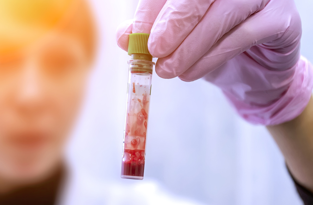 孕妇血液样本在基因检测中的重要作用