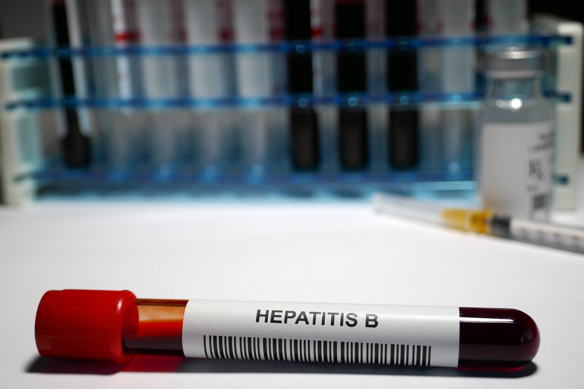 小王是临床见习的同学在给患者测指尖血糖的时 候不小心被患者用过的针扎了一下。查看患者的 病历发现患者 HBsAg 阳性HBV-DNA16×10^5 IUml其他感染筛查均阴性。小王对自己既往是否 接种过乙肝疫苗不清楚很担心会感染上乙型肝炎 他下一步该怎么办