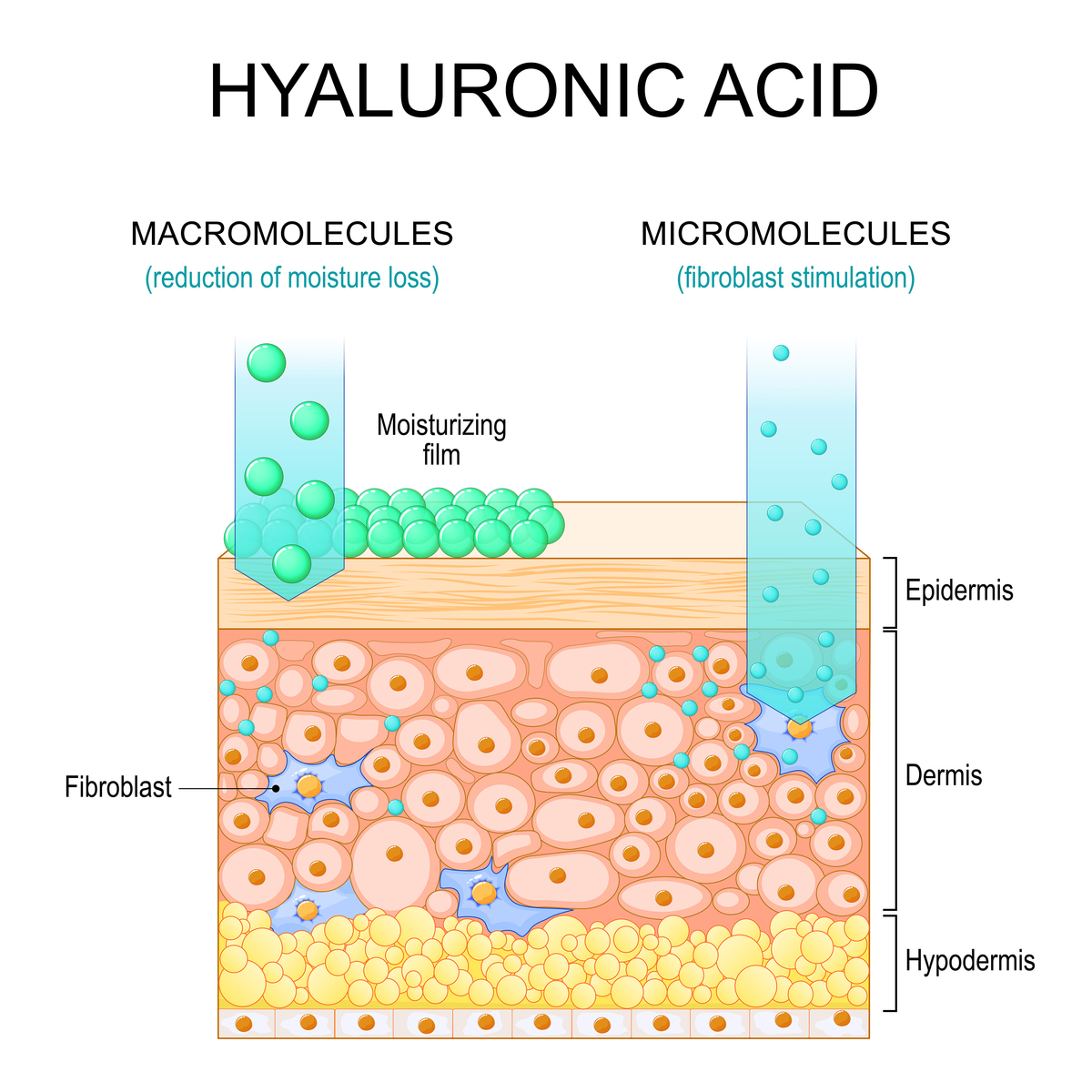 non-Hermitian skin effect是什么意思