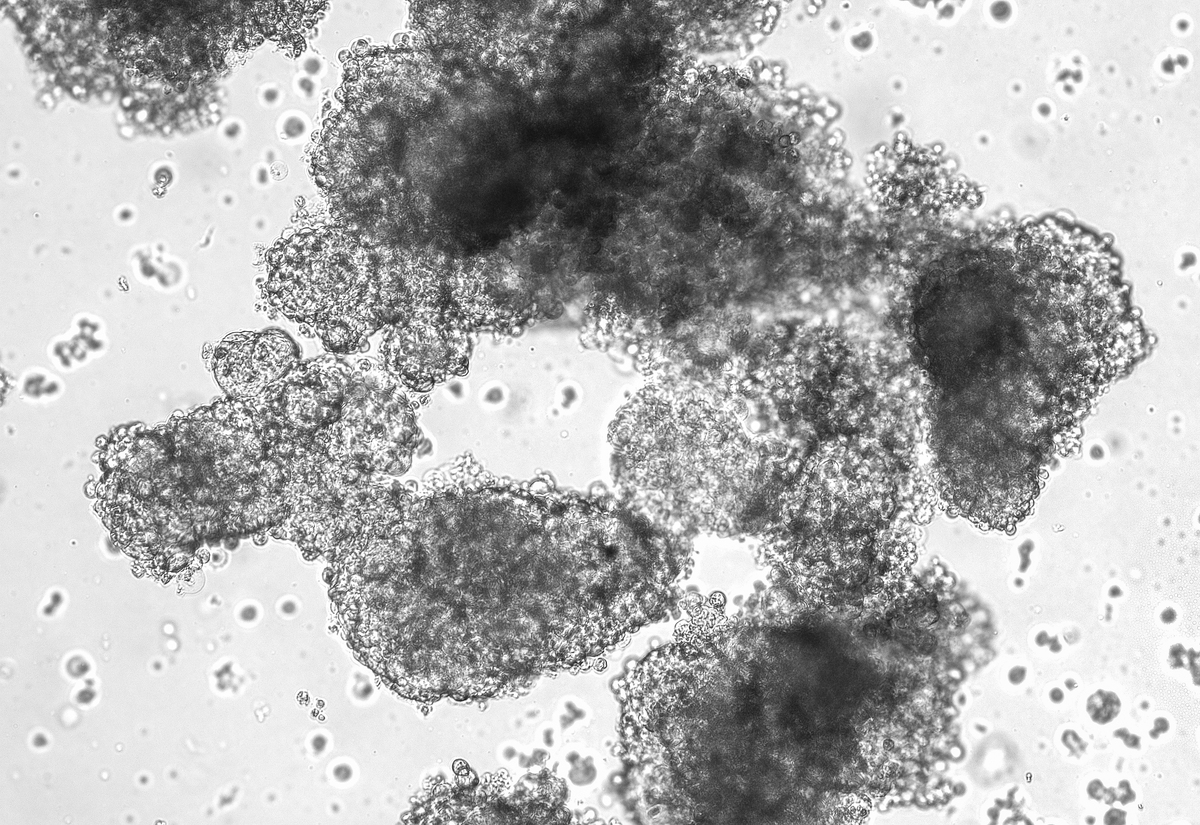 In Vitro Impact of EBL Concentration on Oxidative Stress in Mouse Liver Cells