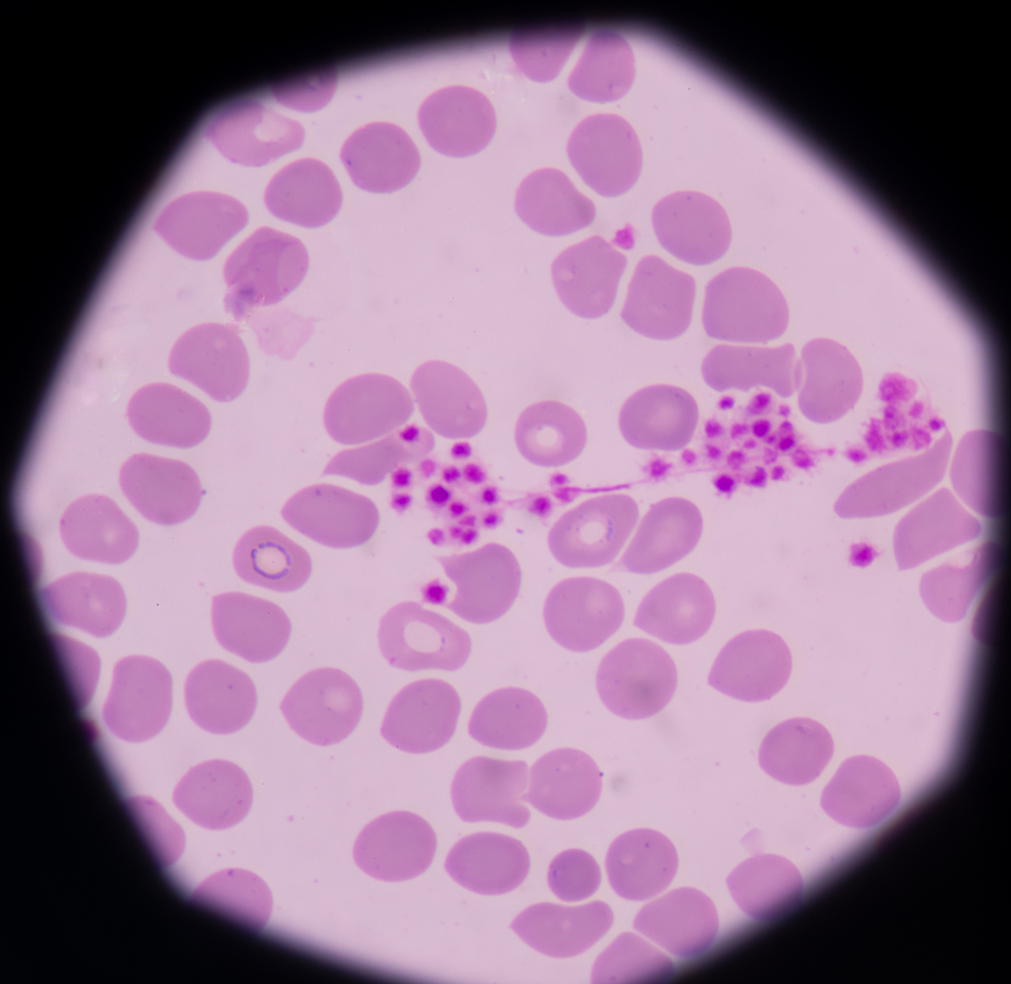 QR值测量：解读血小板功能的关键指标