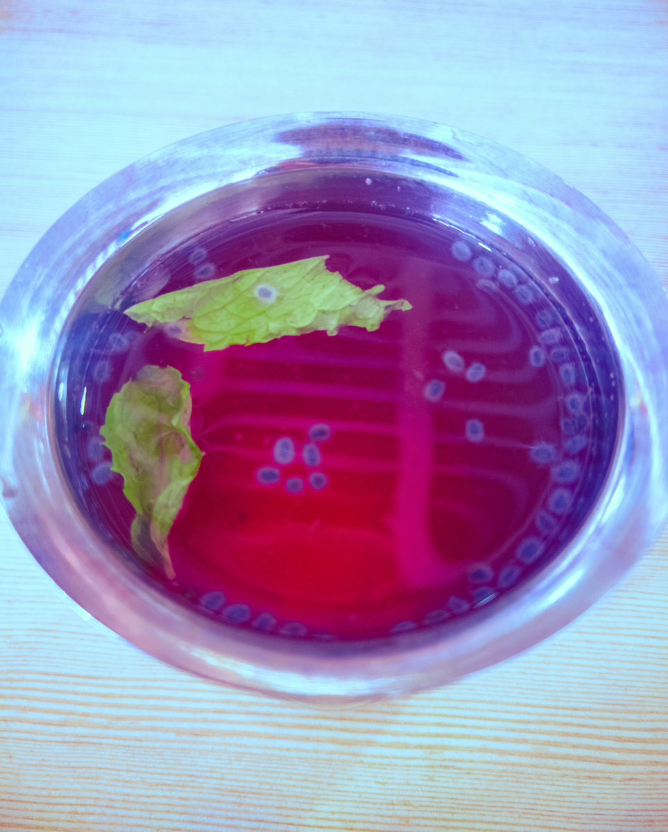 大肠埃希菌在KIA培养基上的生长现象及原理