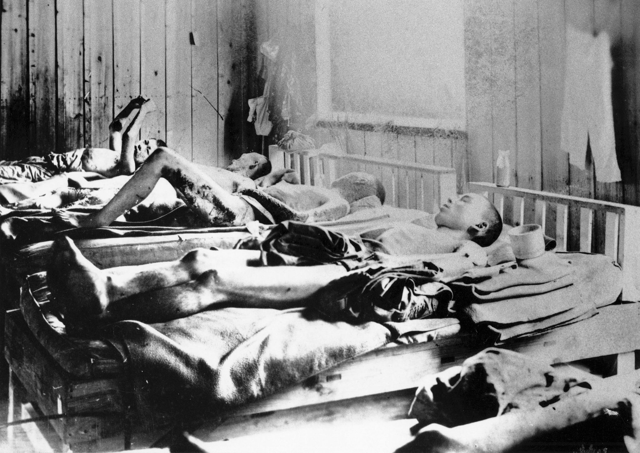 survivors of the explosion of the atom bomb at hiroshima, japan,