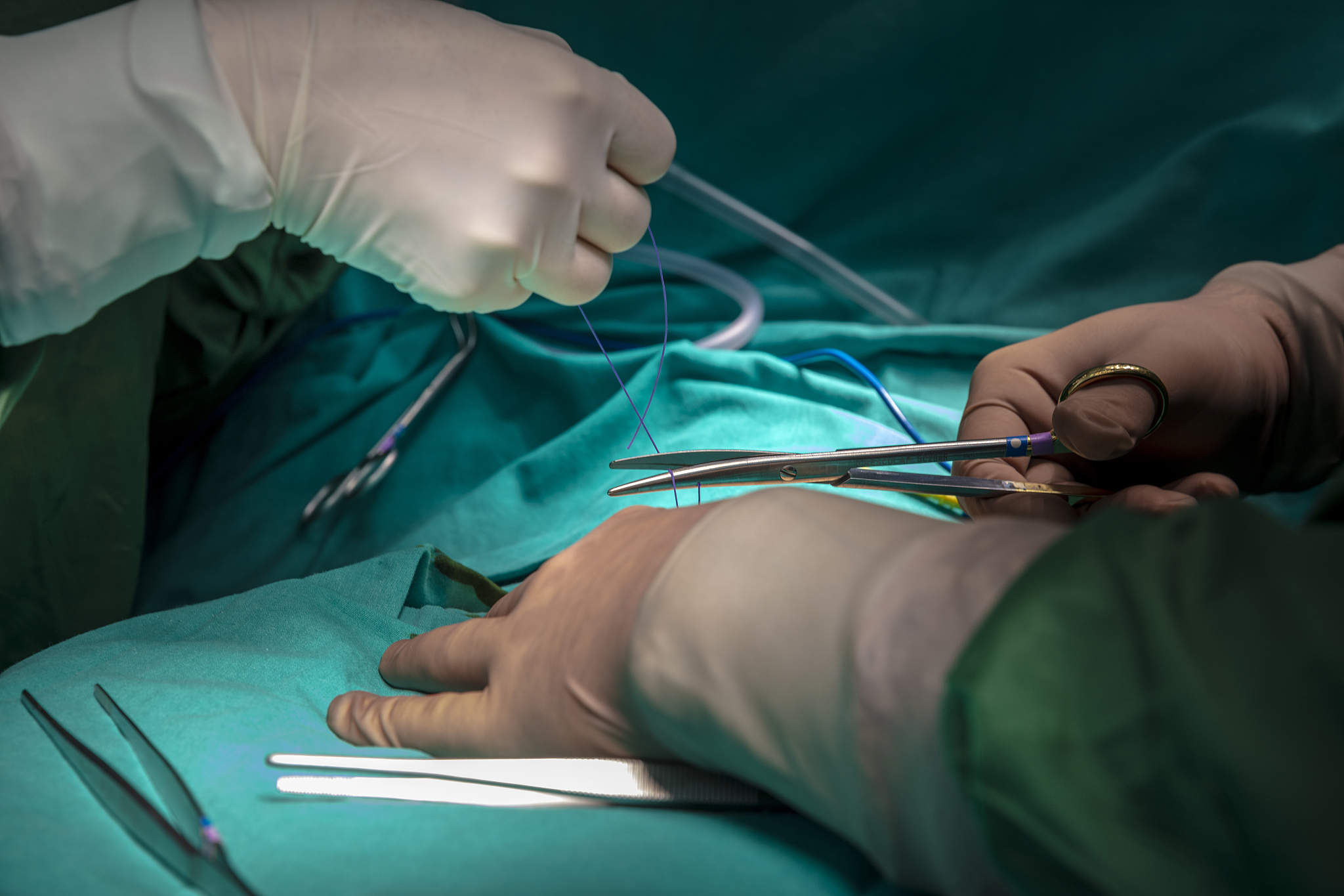 doctor make a surgical stitch