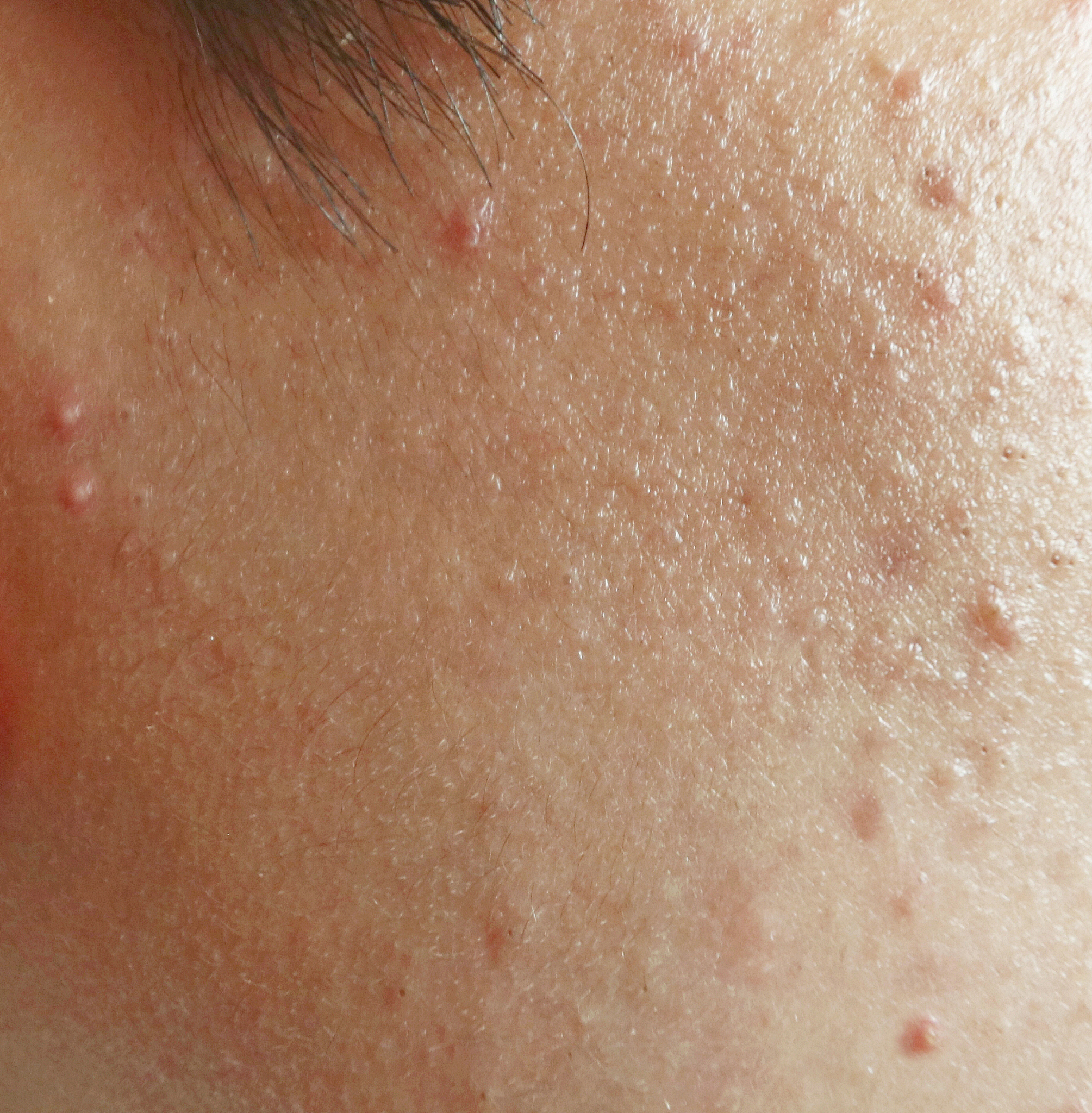 rash on sensitive skin