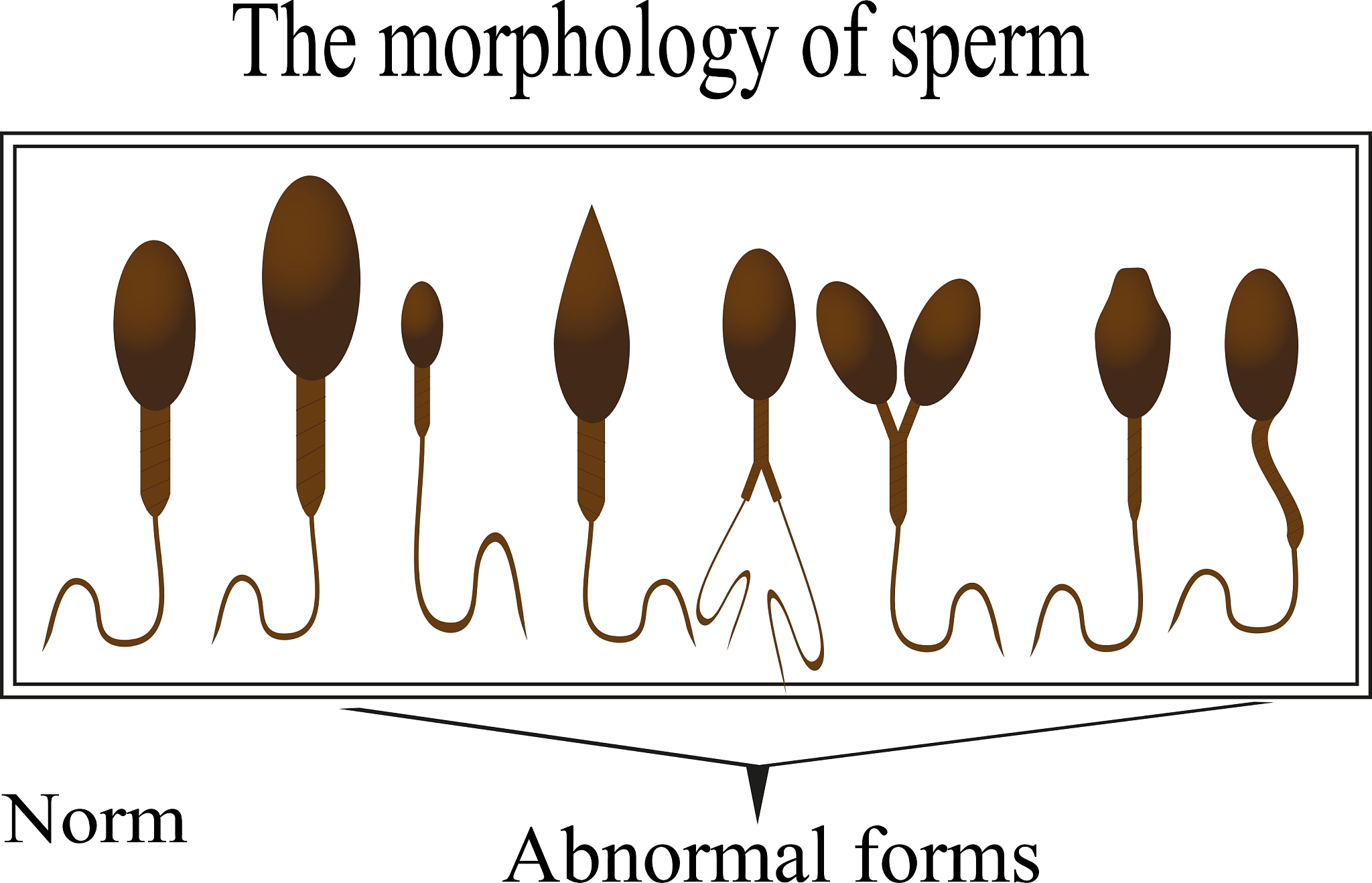 流式细胞术在精子学中的应用：揭示精子衰老机制和临床应用潜力