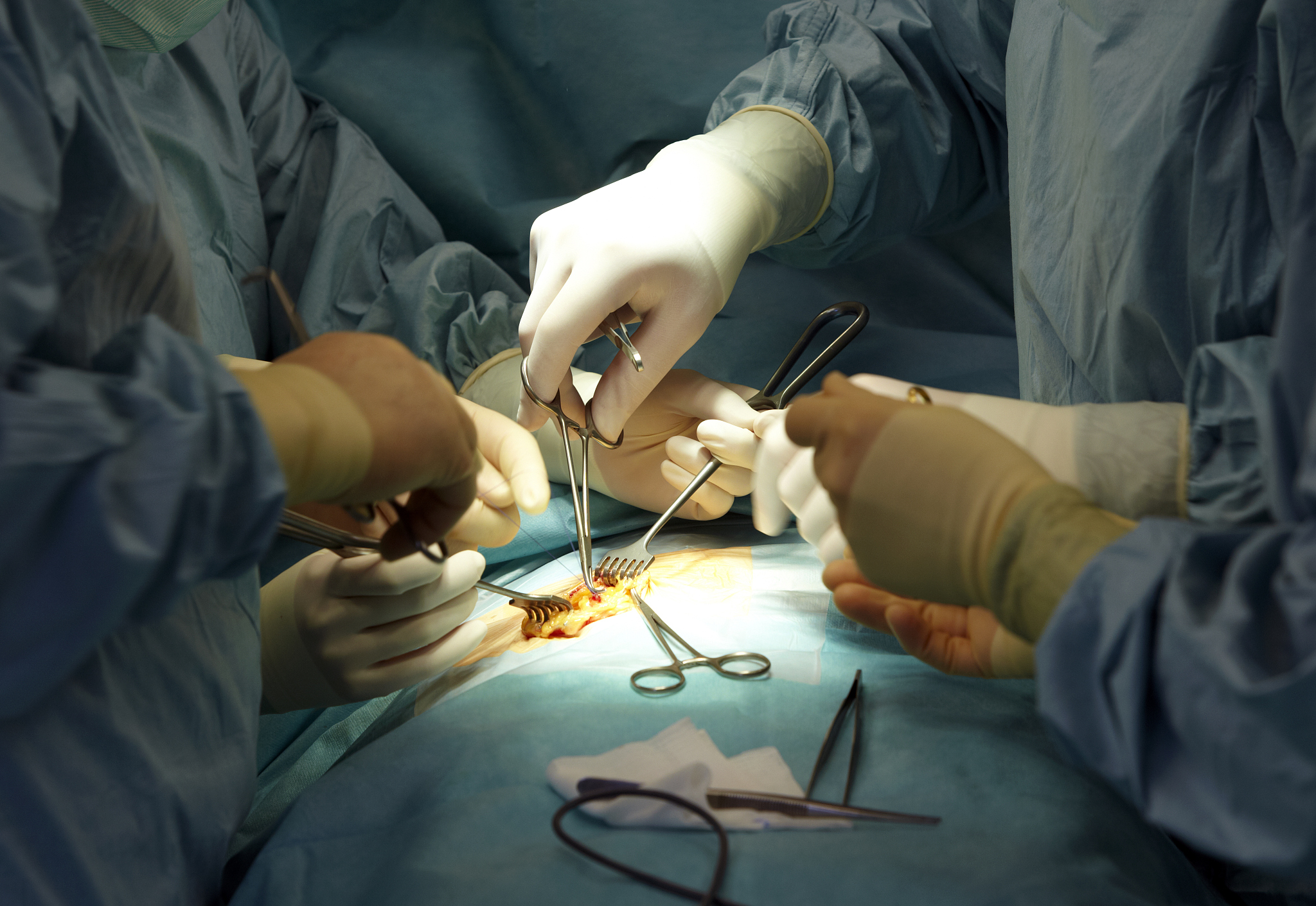 surgery